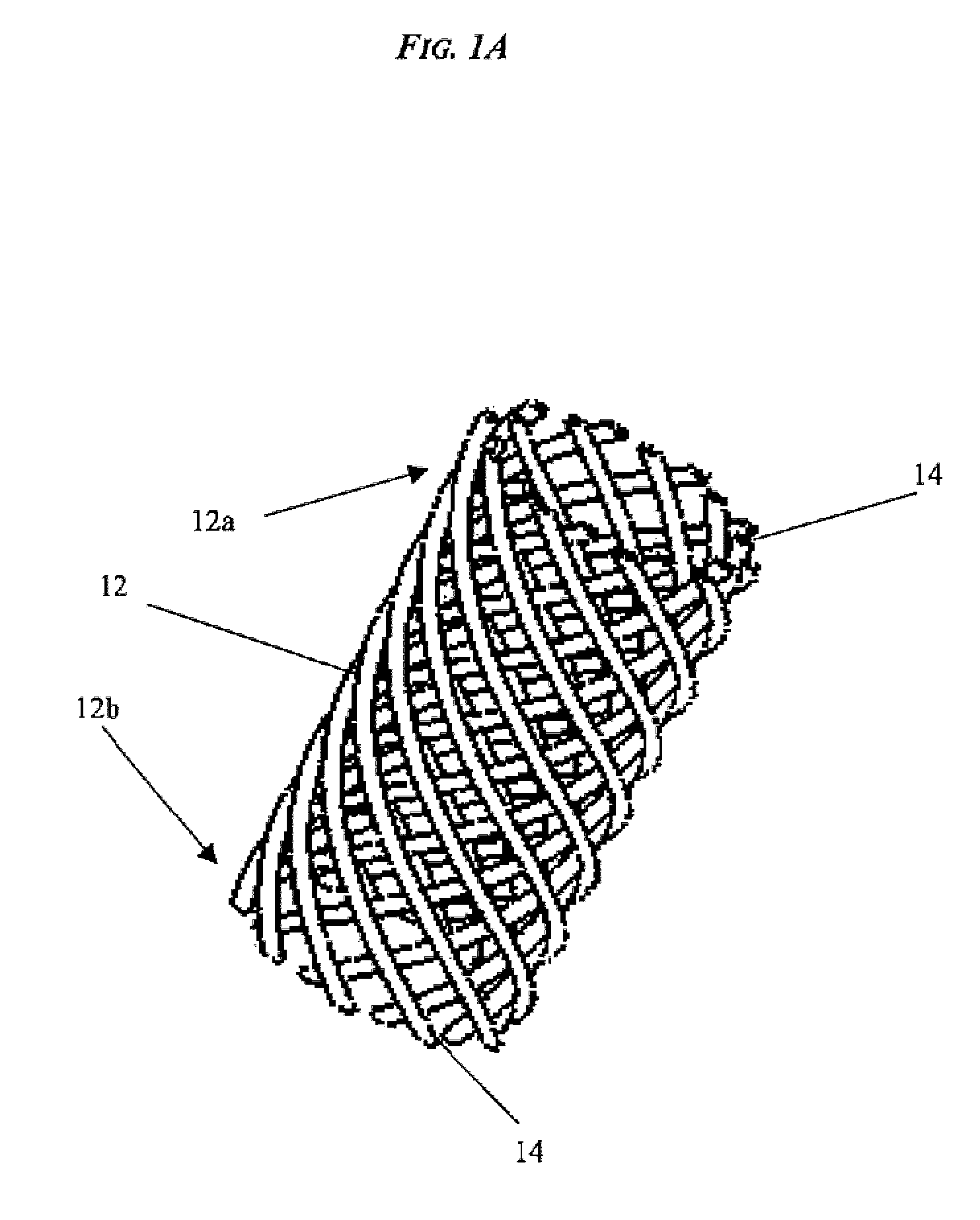 Internally Placed Gastric Restriction Device
