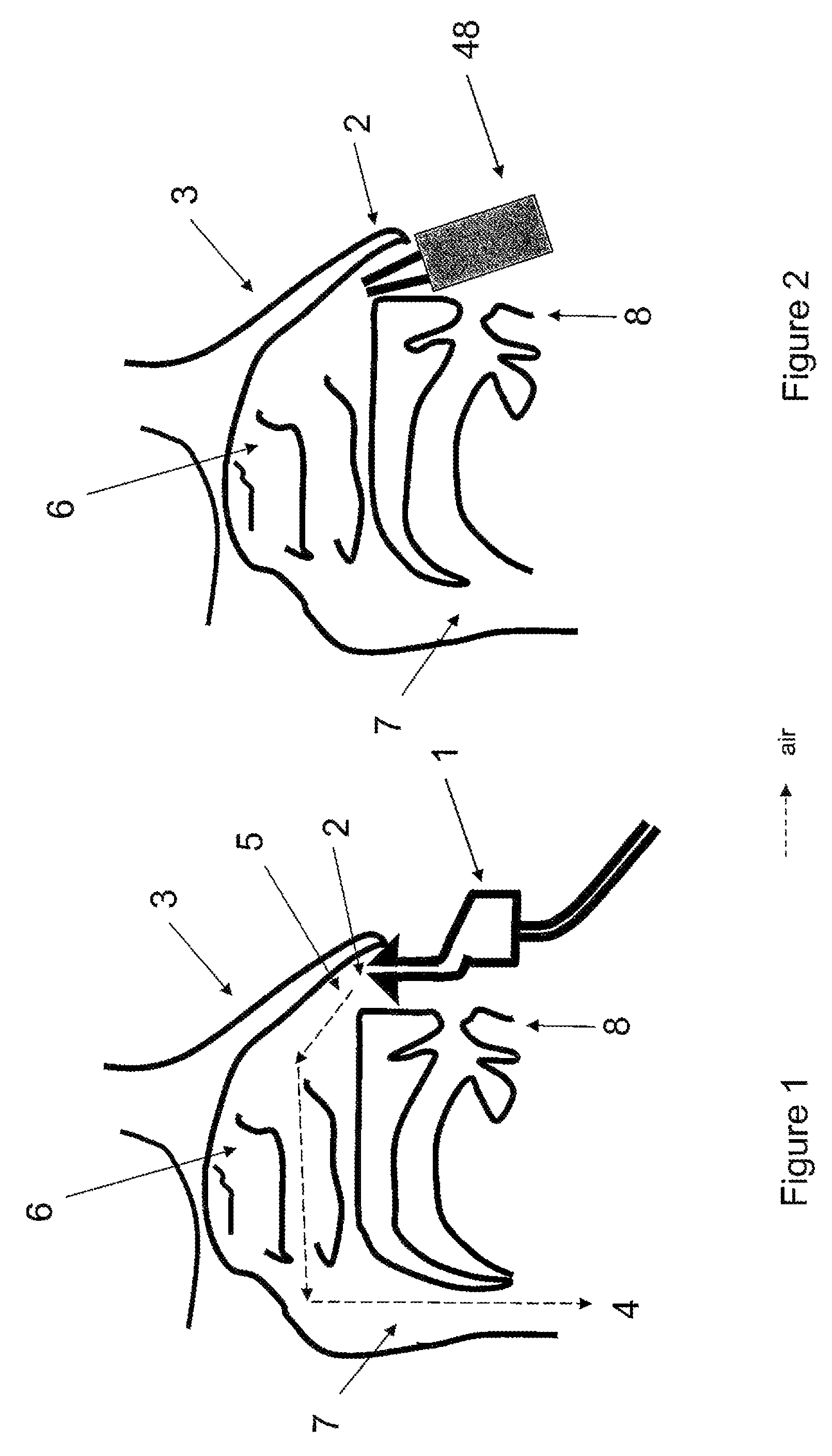 Device for oral administration of an aerosol for the rhinopharynx, the nasal cavities or the paranasal sinuses