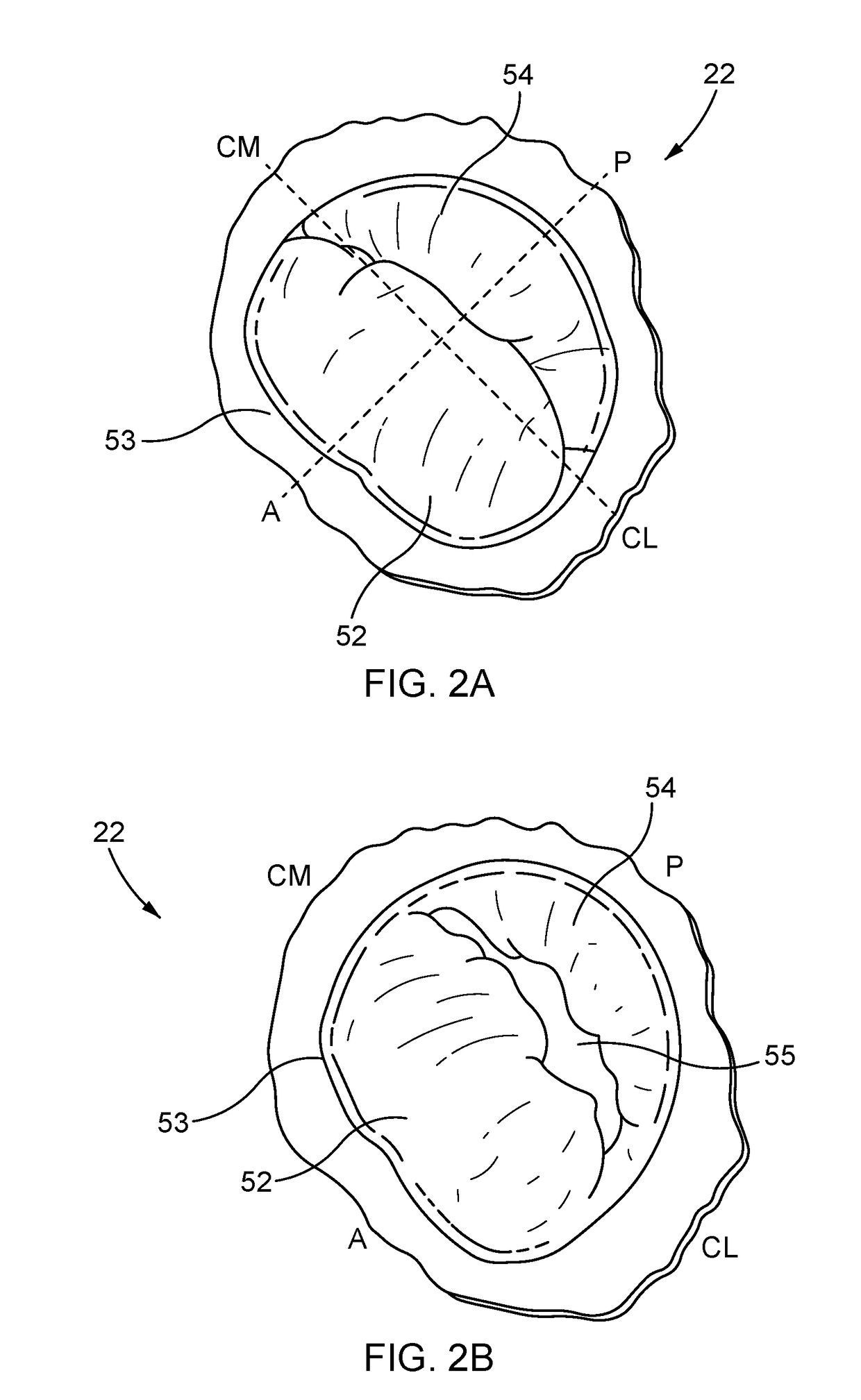 Distal anchor apparatus and methods for mitral valve repair