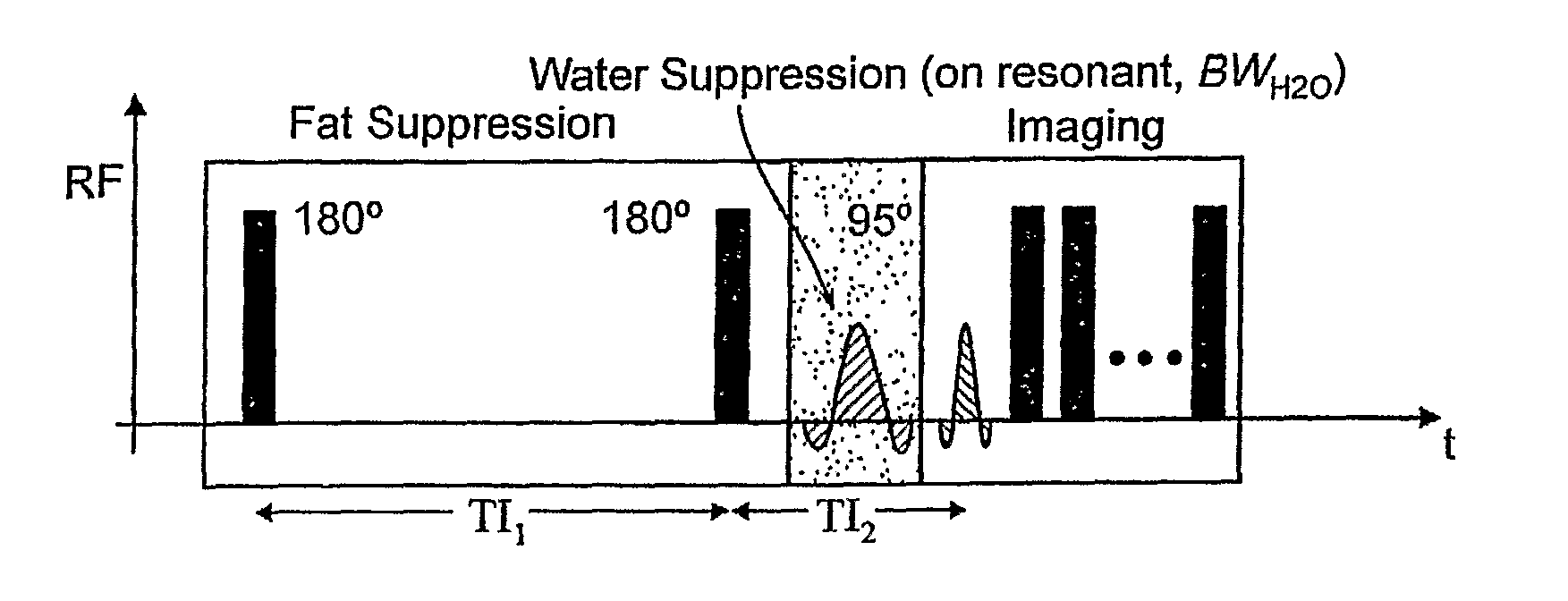 Method for magnetic resonance imaging using inversion recovery with on-resonant water suppression including MRI systems and software embodying same