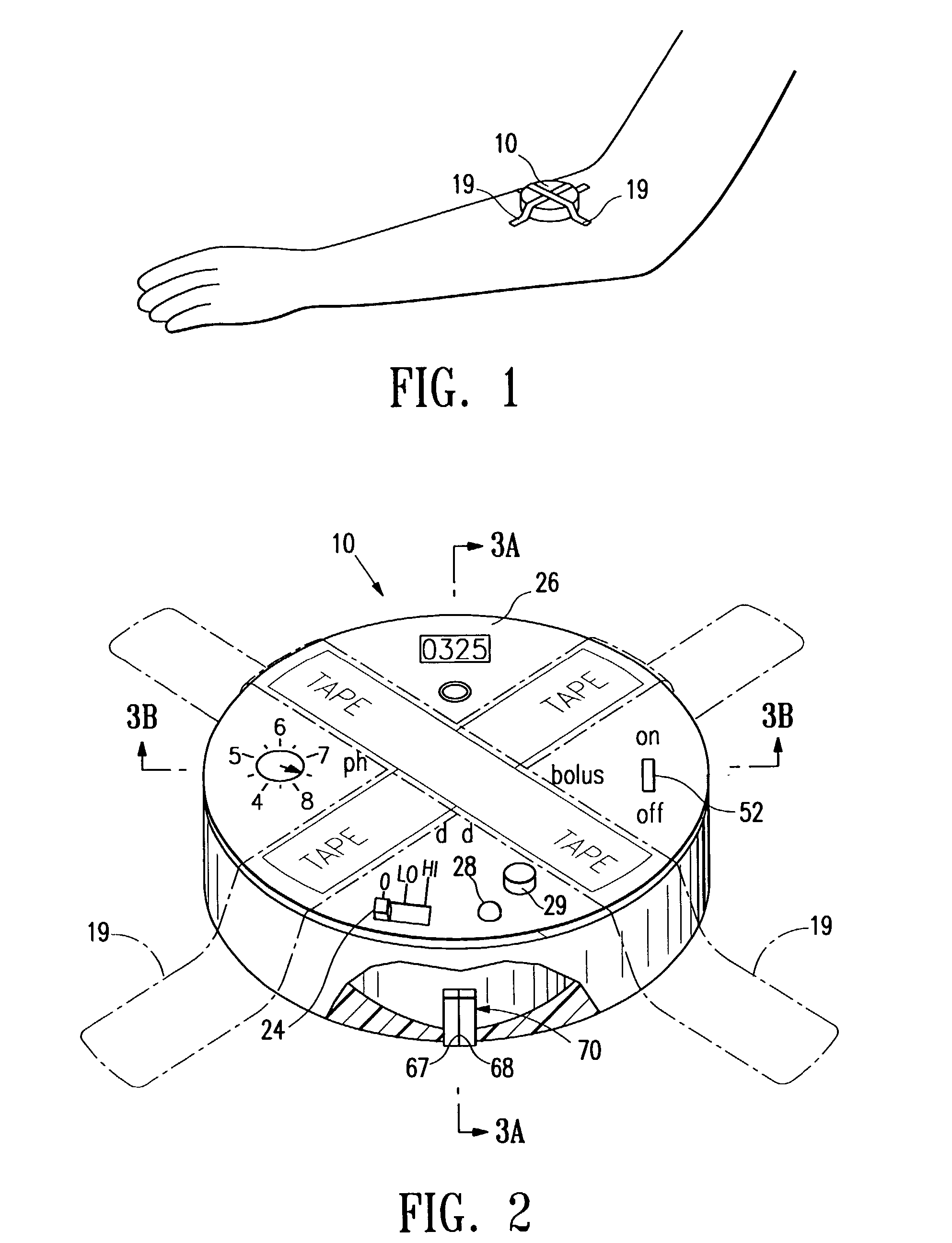Sensor controlled analysis and therapeutic delivery system