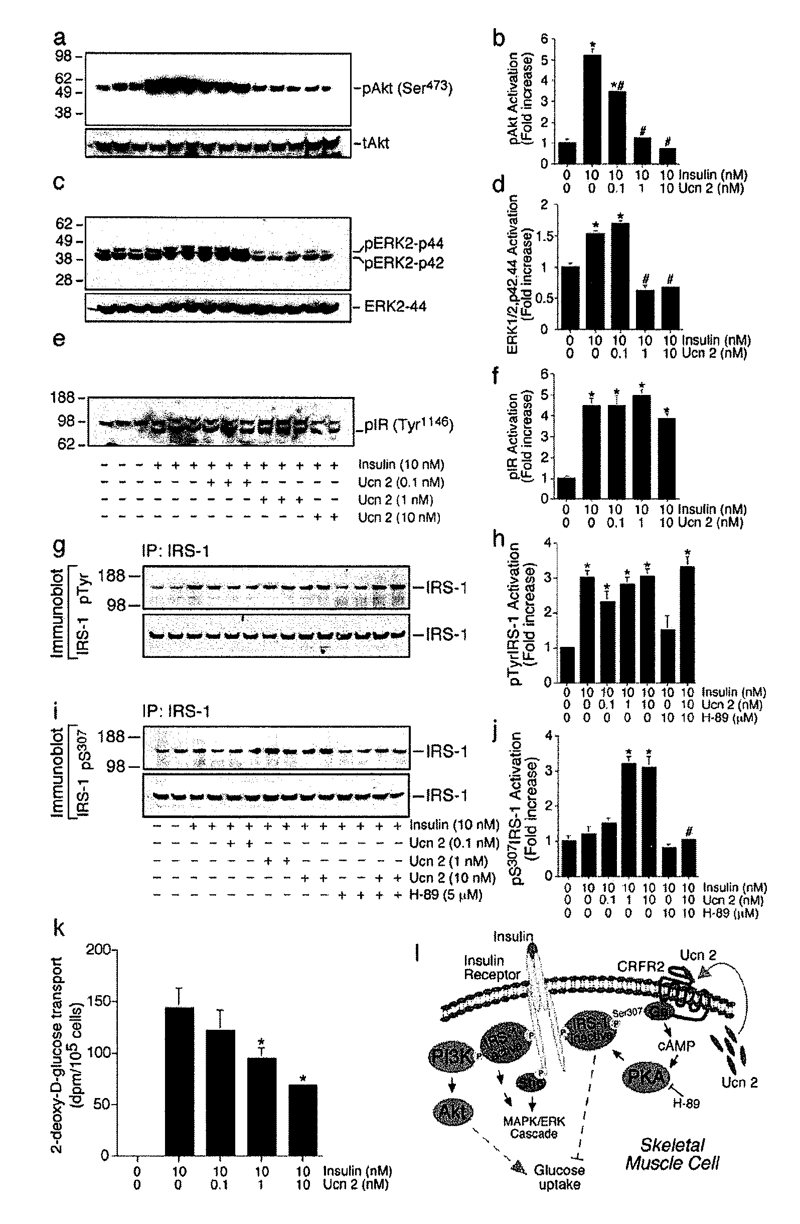 Corticotropin releasing factor receptor-2 inhibitors and uses thereof