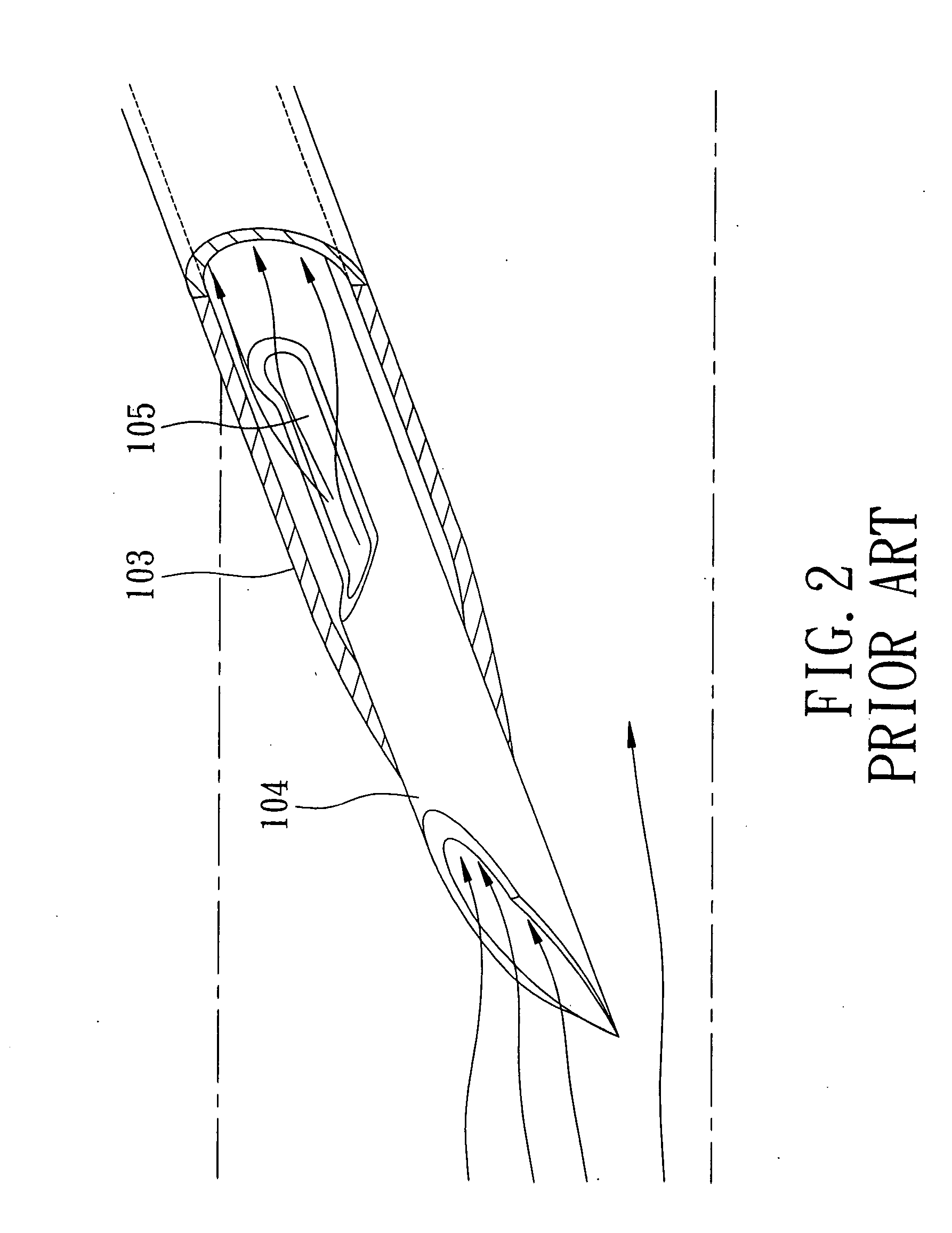 Intravenous catheter introducing device with a tubular outlet member