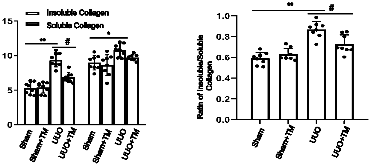 Application of ammonium tetrathiomolybdate in preparation of medicine used for treating renal interstitial fibrosis