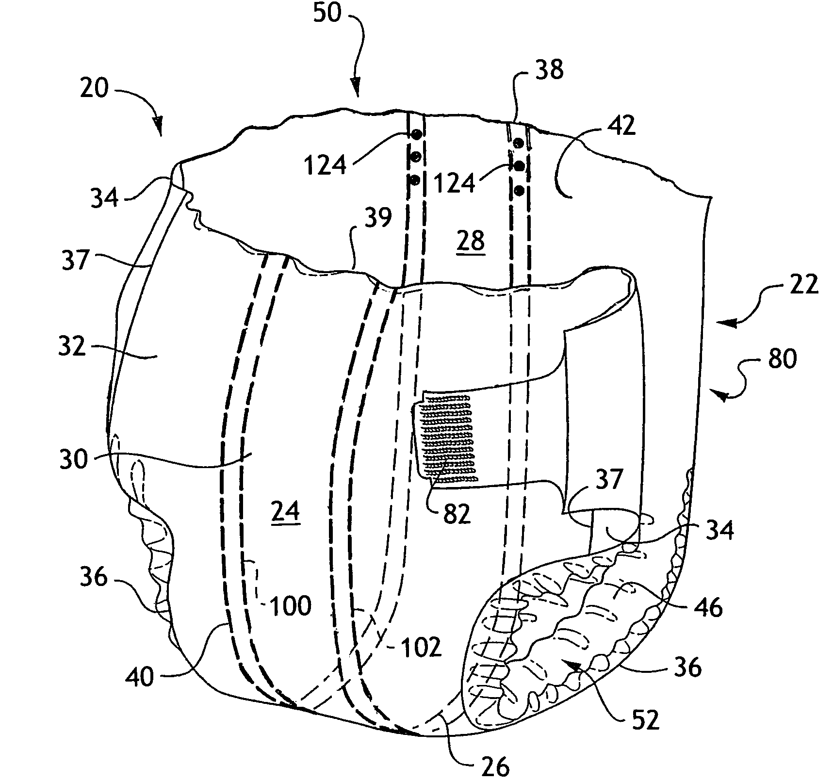 Absorbent articles with external access to internal conductors