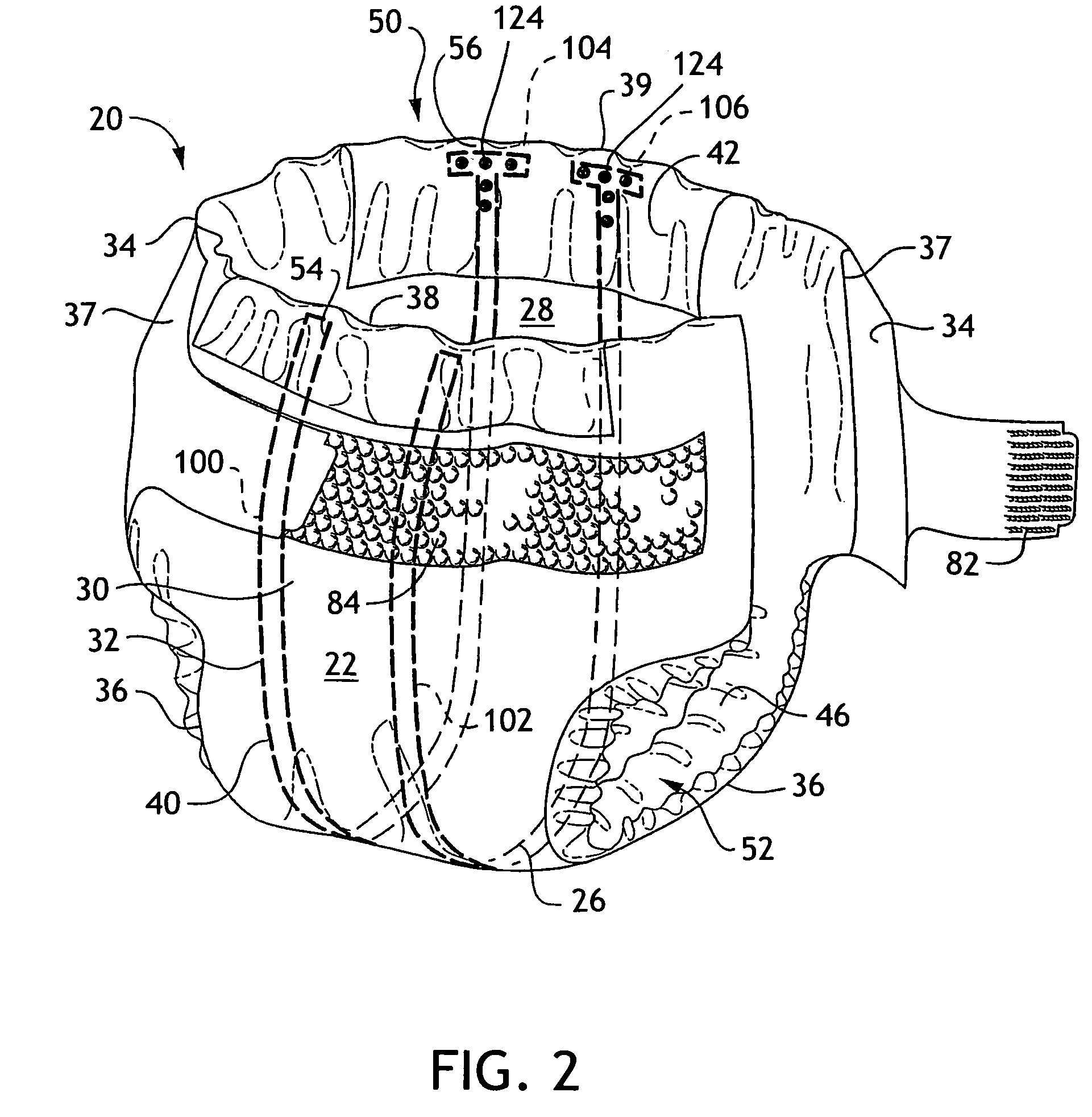 Absorbent articles with external access to internal conductors
