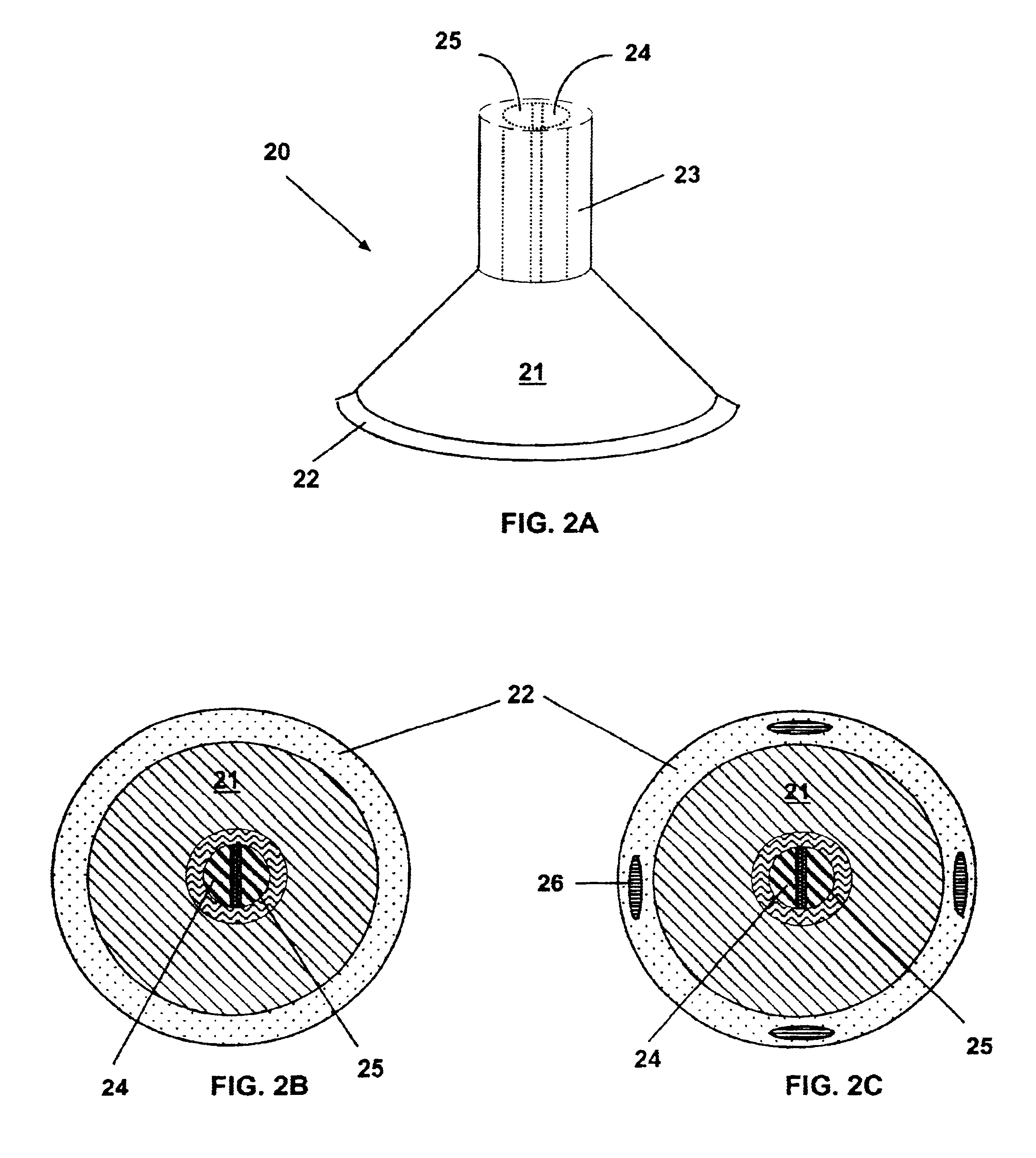 Methods and devices for reducing the mineral content of a region of non-intimal vascular tissue