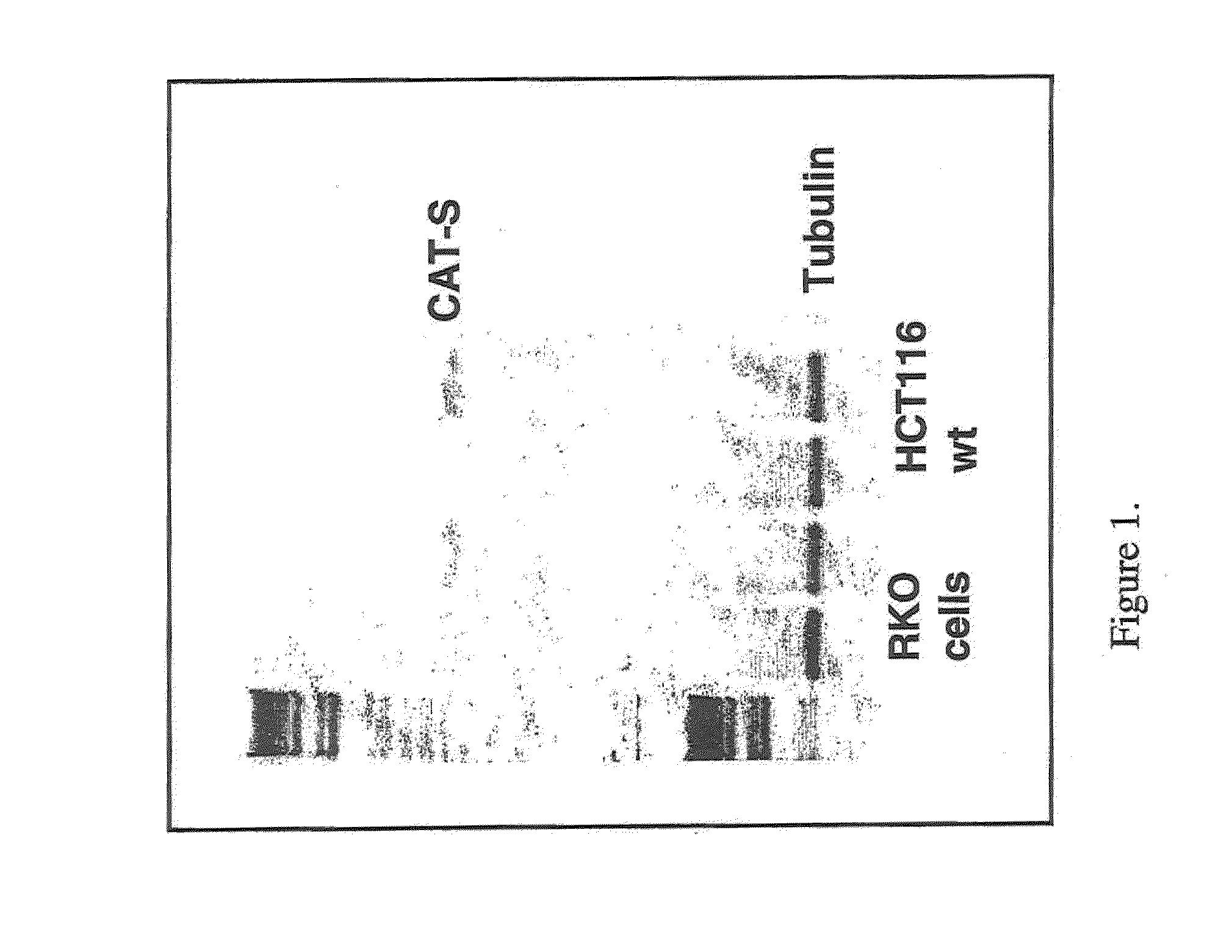 Therapy targeting cathepsin S