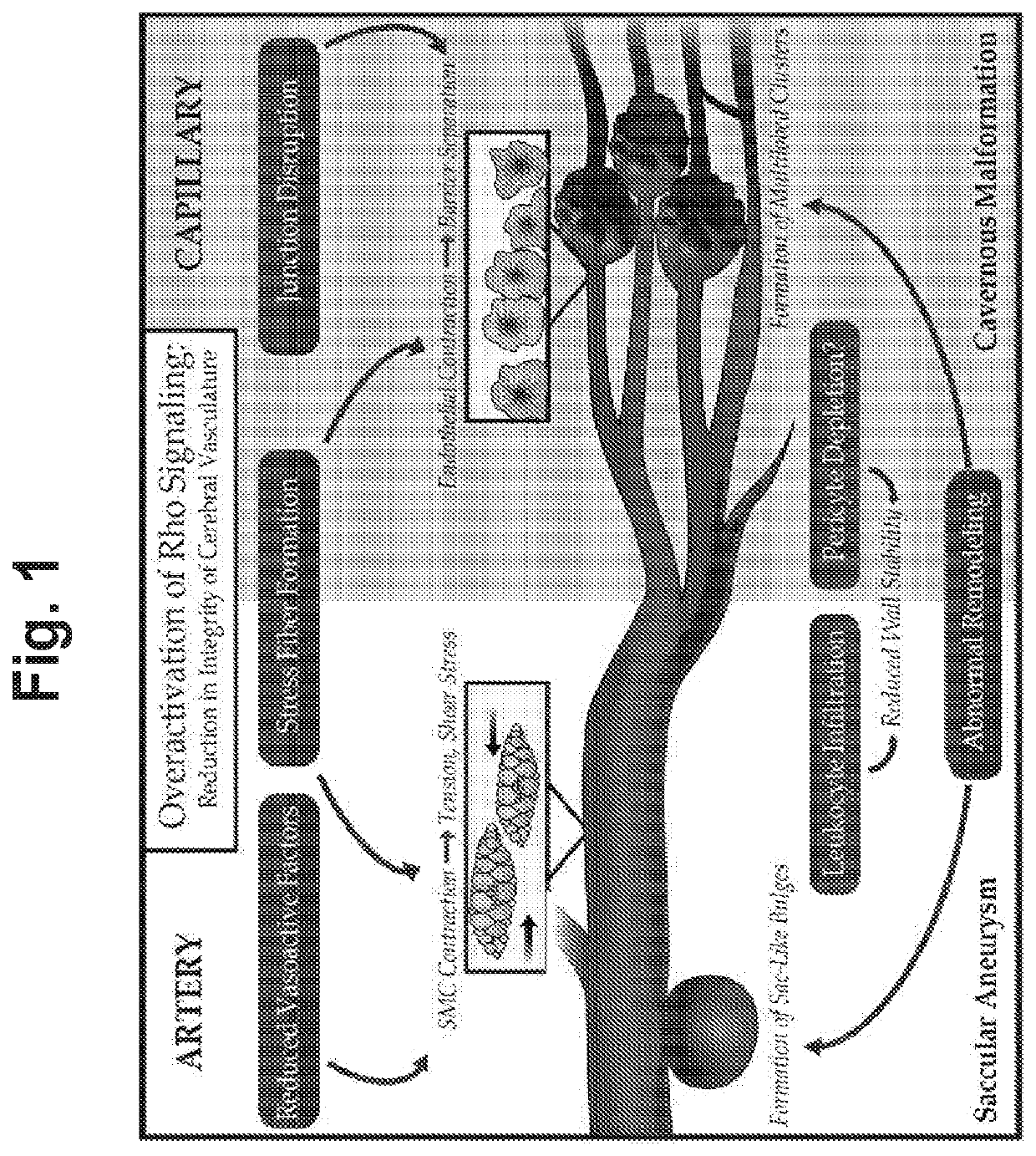 Treatment of cerebral cavernous malformations and cerebral aneurysms with rho kinase inhibitors