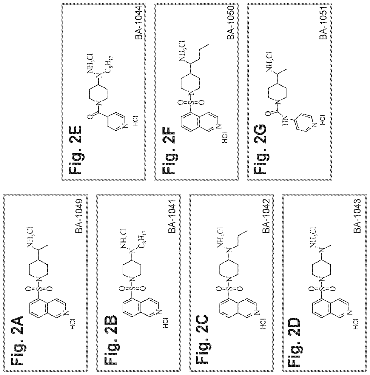 Treatment of cerebral cavernous malformations and cerebral aneurysms with rho kinase inhibitors