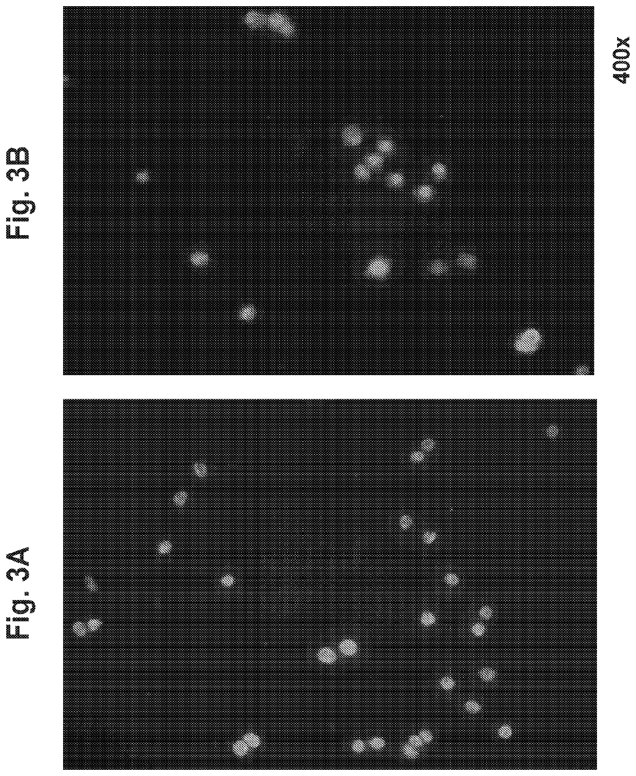 Treatment of cerebral cavernous malformations and cerebral aneurysms with rho kinase inhibitors