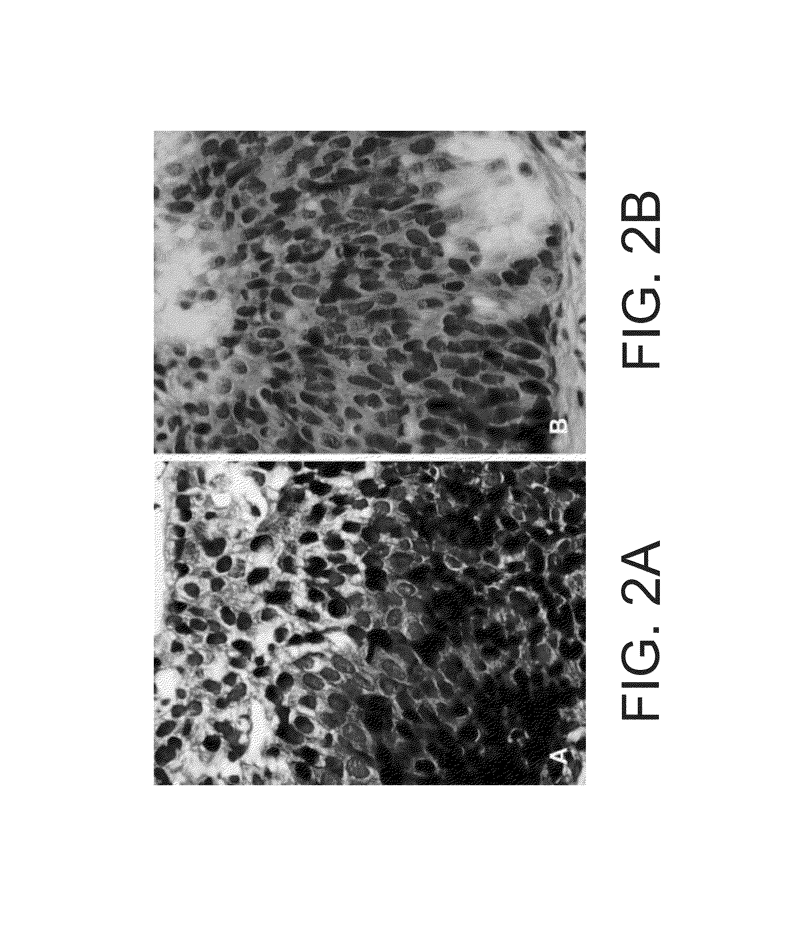 Kits for and methods of differential staining of cervical cancer cells and/or tissues