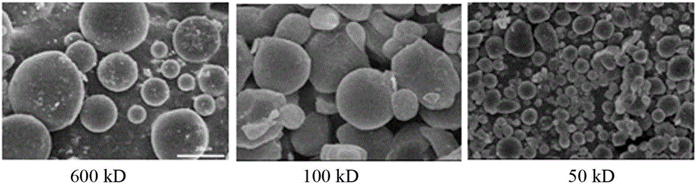 Preparation method and application of chitosan-microsphere immunoaffinity adsorbent