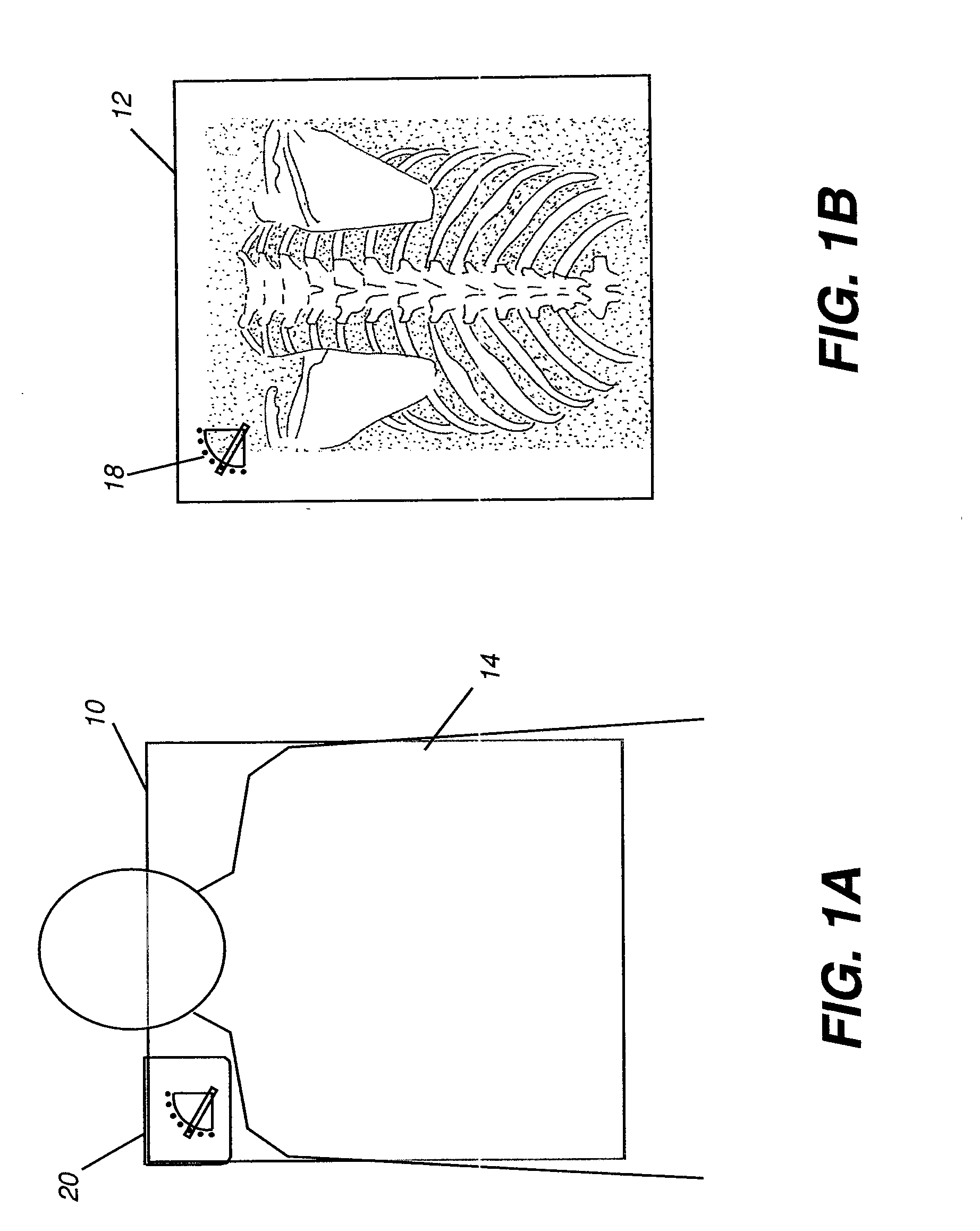 Radiographic marker for inclination angle