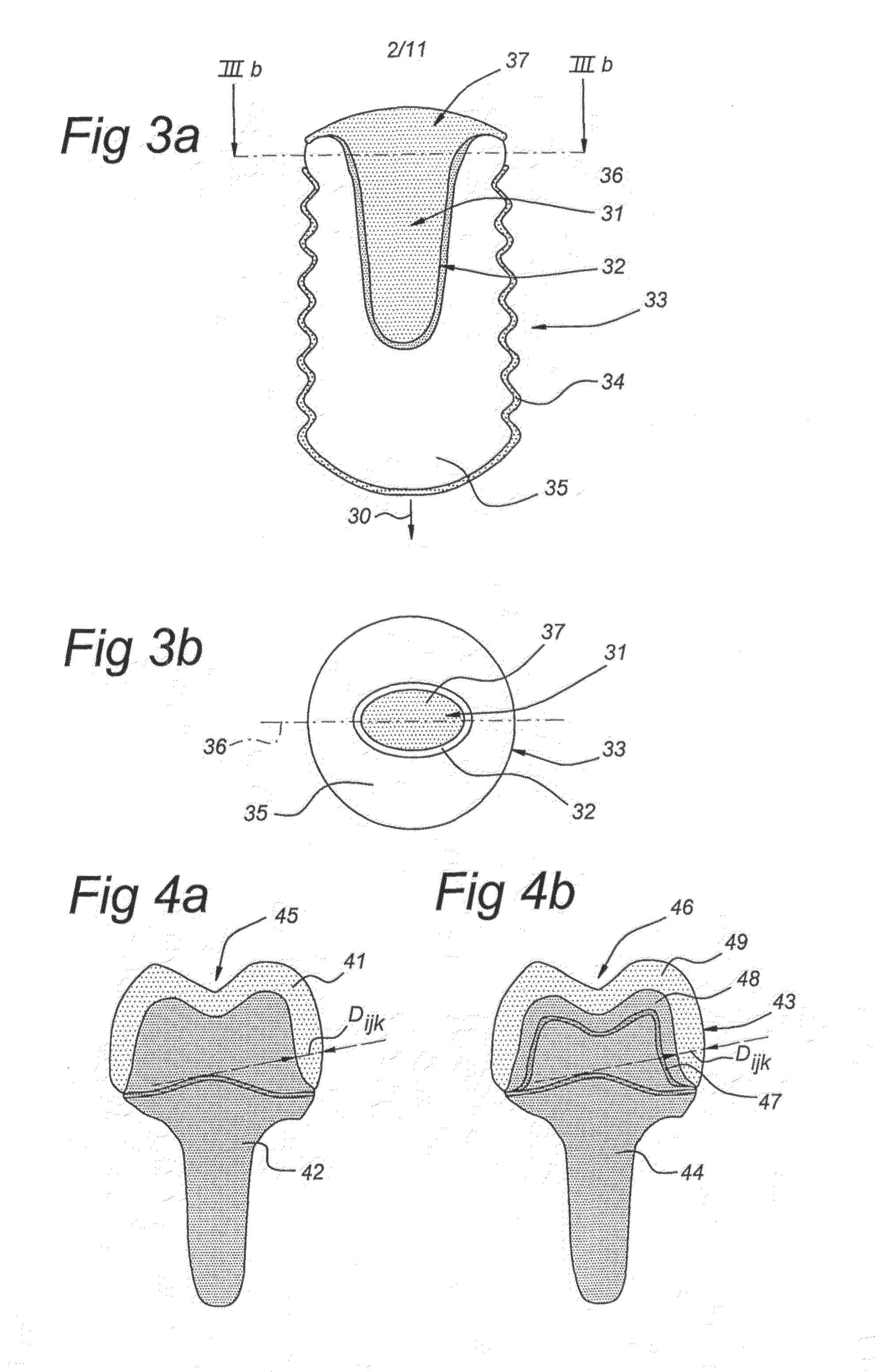 Method of manufacturing and installing a ceramic dental implant with an aesthetic implant abutment