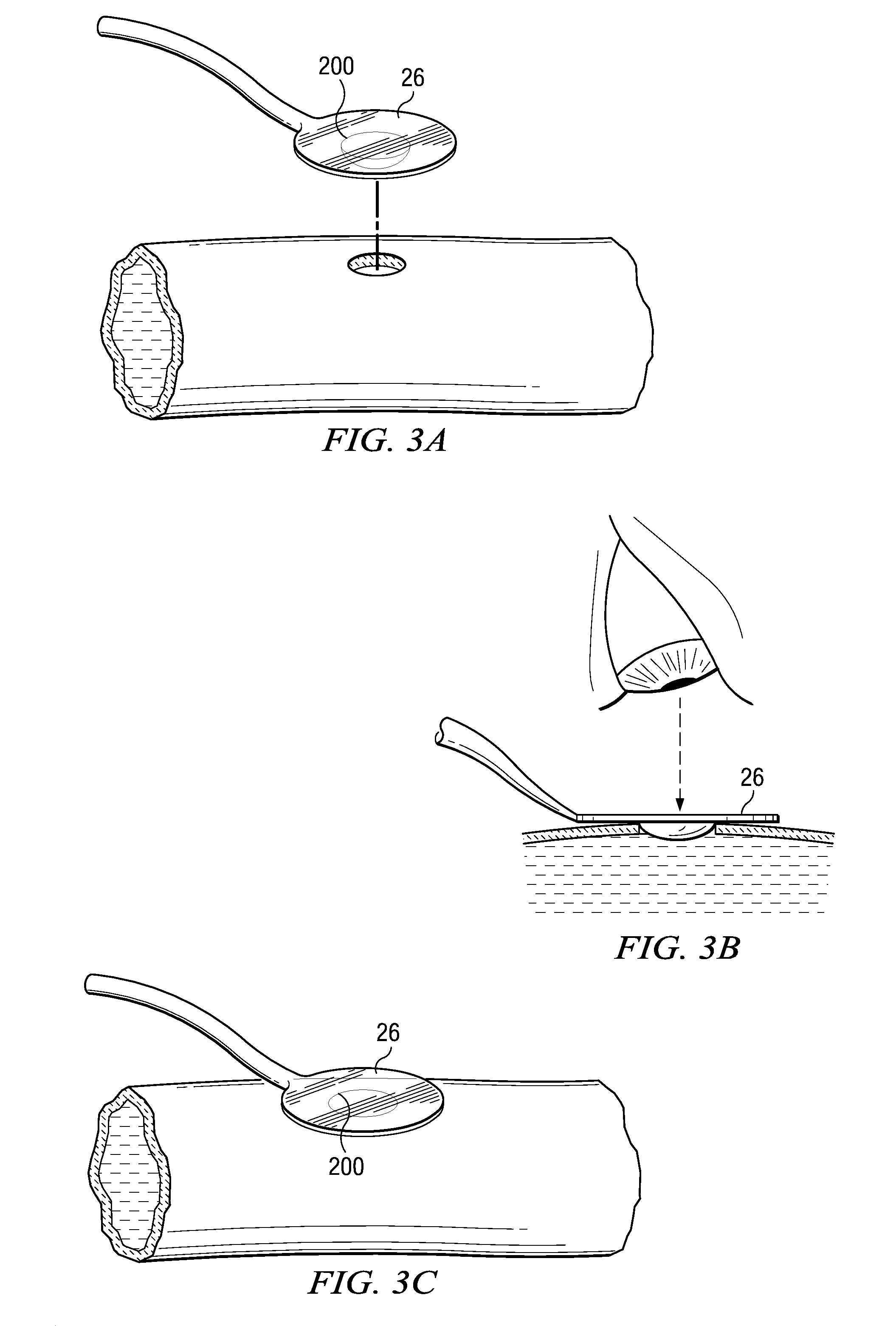 System and method for providing an obturator for enhanced directional capabilities in a vascular environment