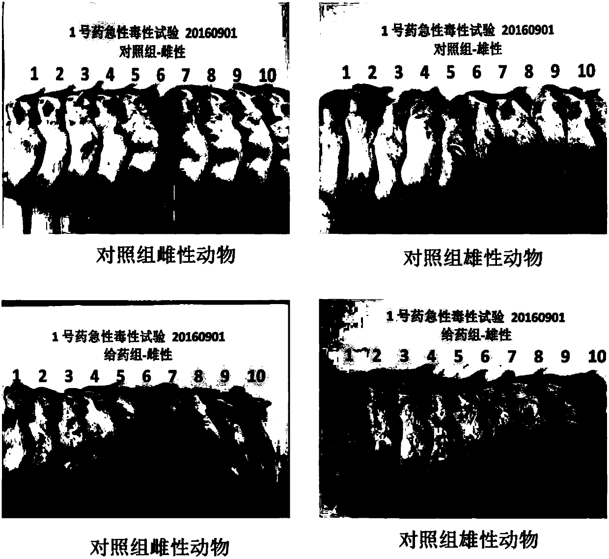 Drug for targeted therapy of breast cancer and application thereof