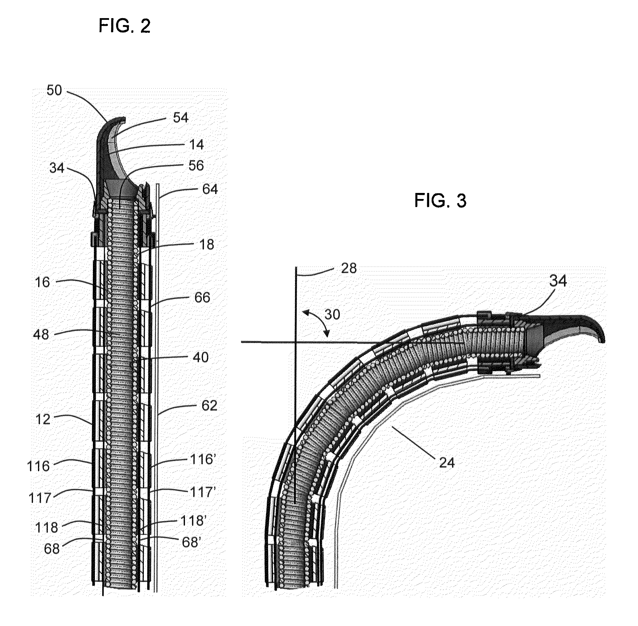Apparatus and methods for removal of intervertebral disc tissues