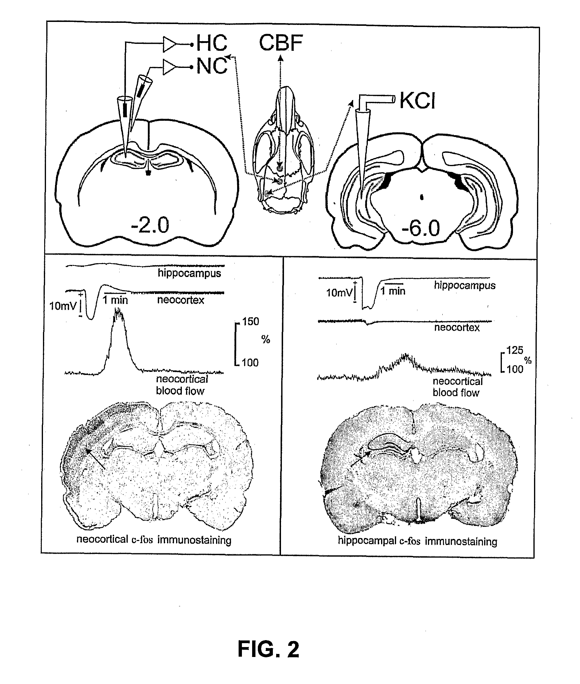 Compositions and Method for Brain Specific Targeted Delivery of Therapeutic Agents