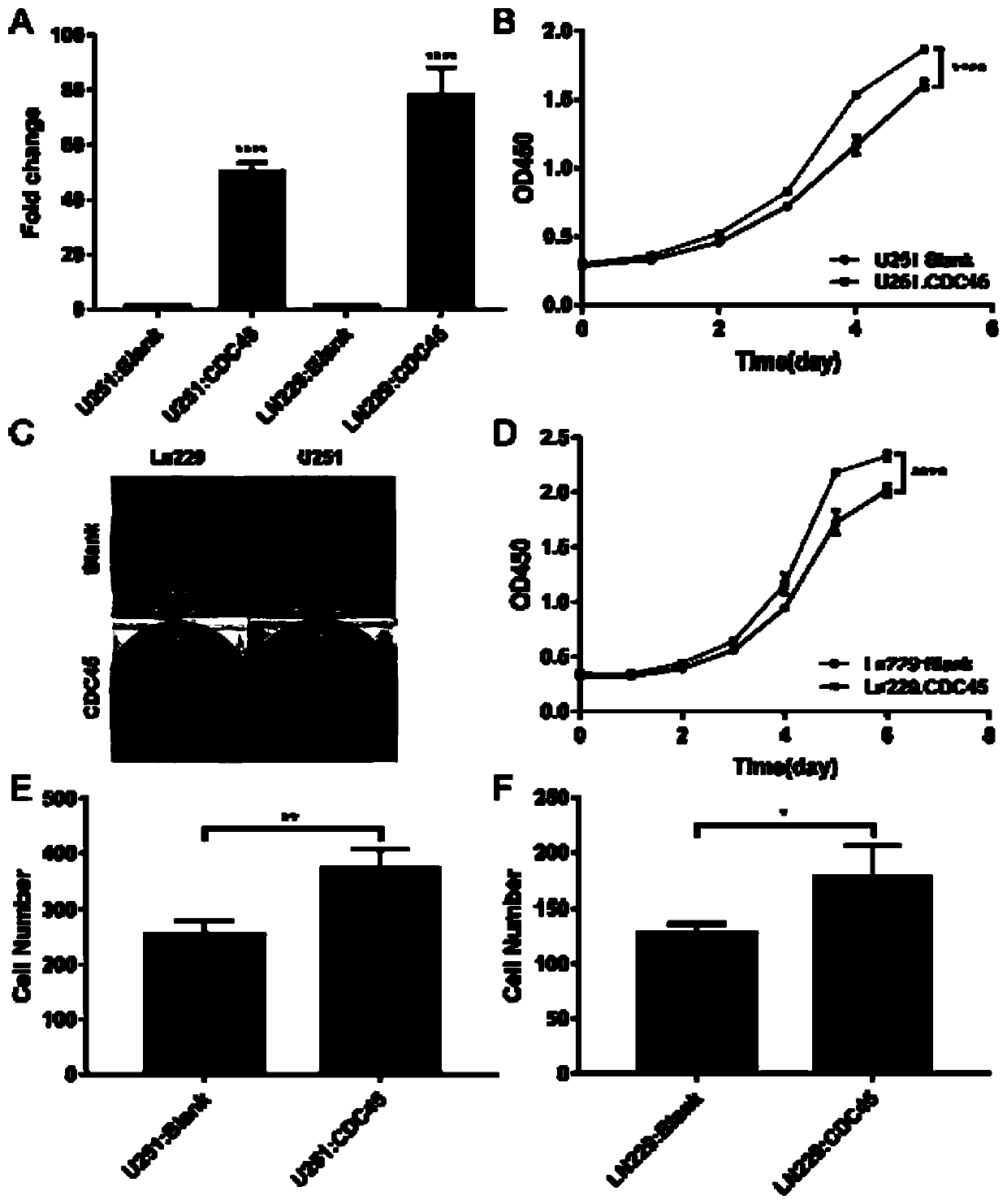 CDC45 as marker of glioblastoma multiforme and application of CDC45 as therapeutic target