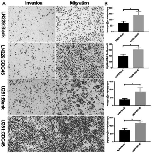 CDC45 as marker of glioblastoma multiforme and application of CDC45 as therapeutic target