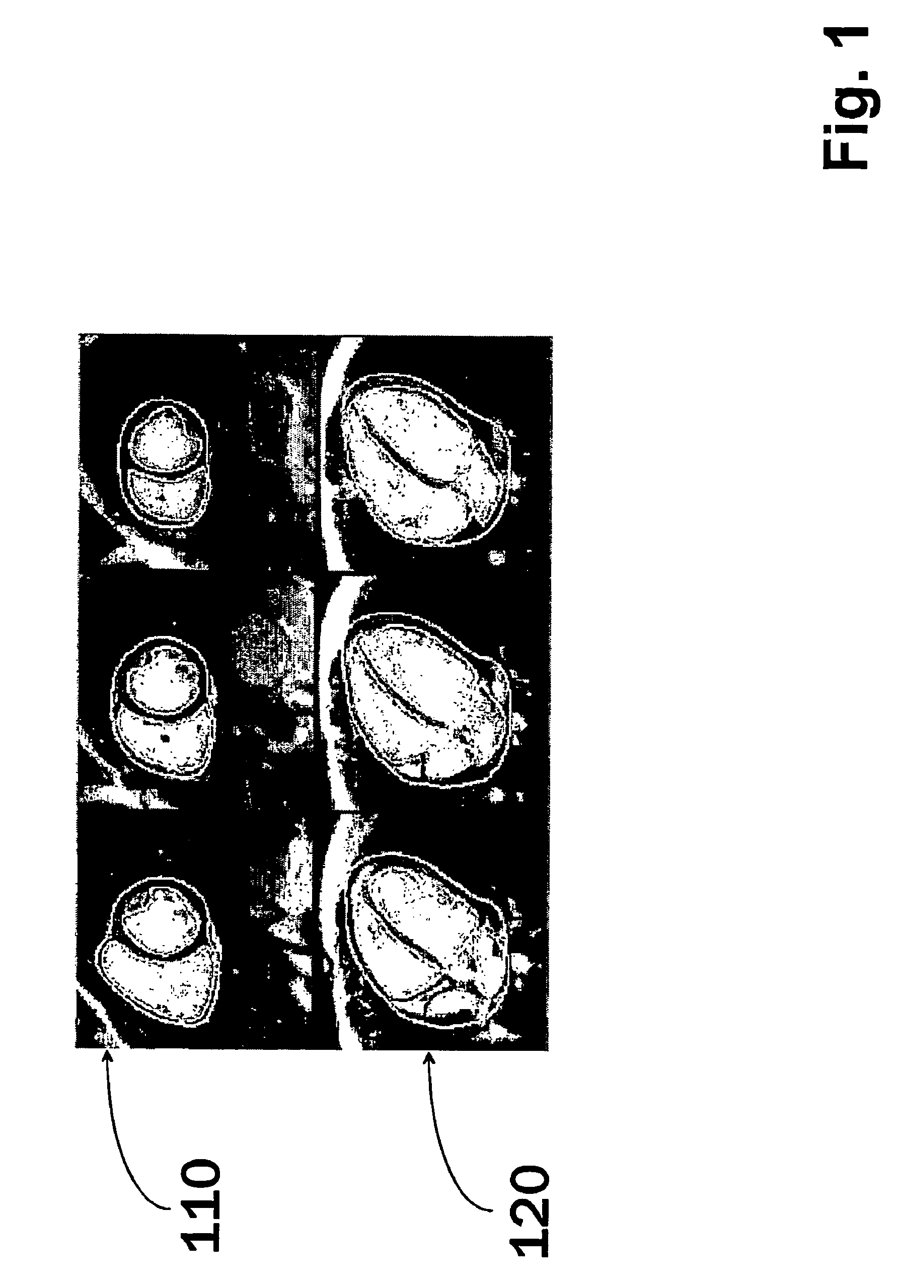 Method for processing slice images