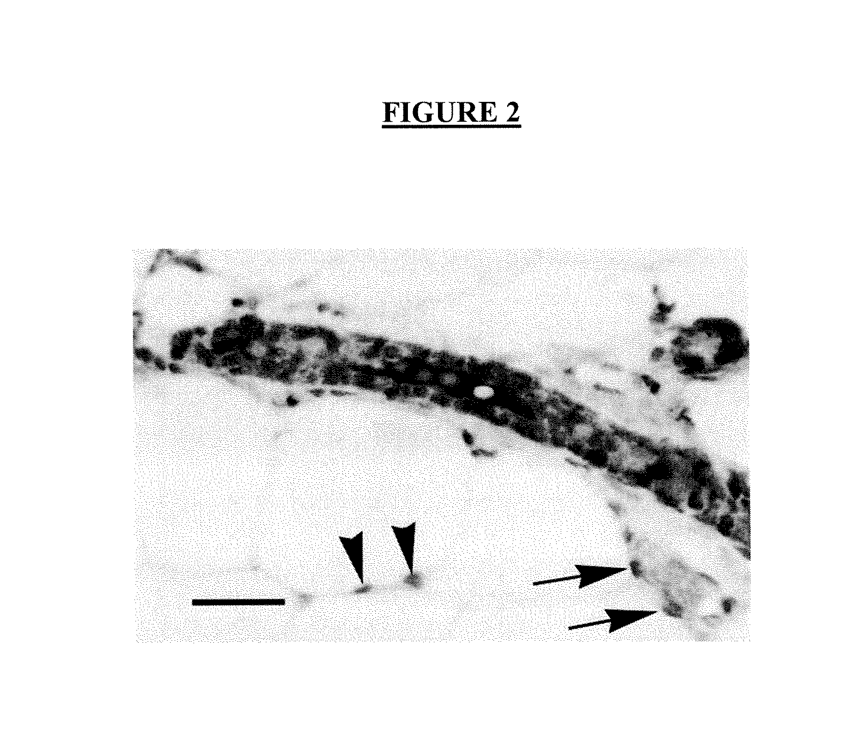 Method for the Discrimination and Isolation of Mammary Epithelial Stem and Colony-Forming Cells