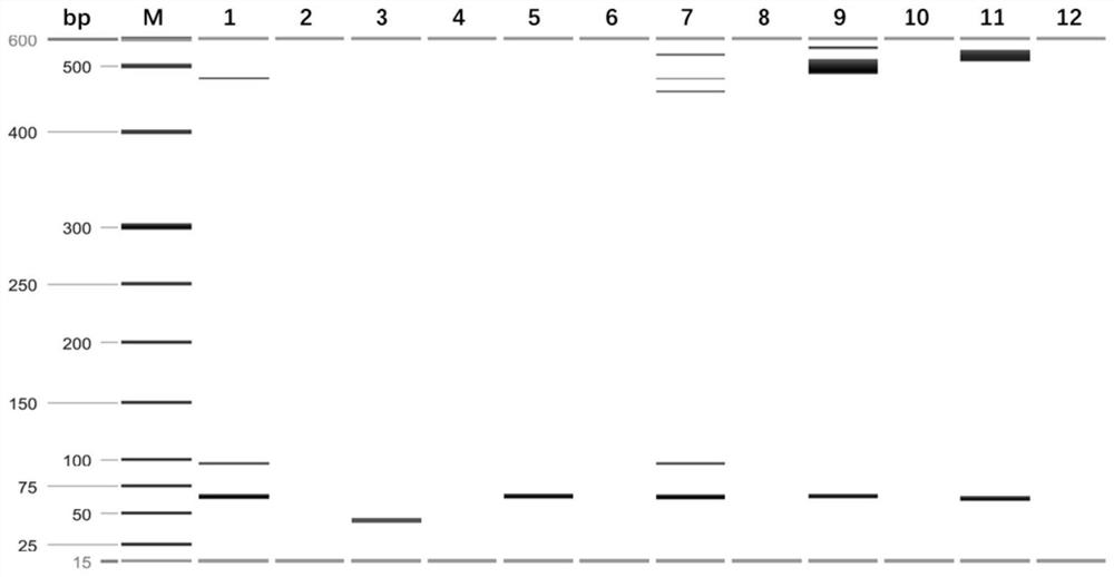 A multiple PCR detection kit for Anopheles glabra, Anopheles multicolored and Anopheles aconitum