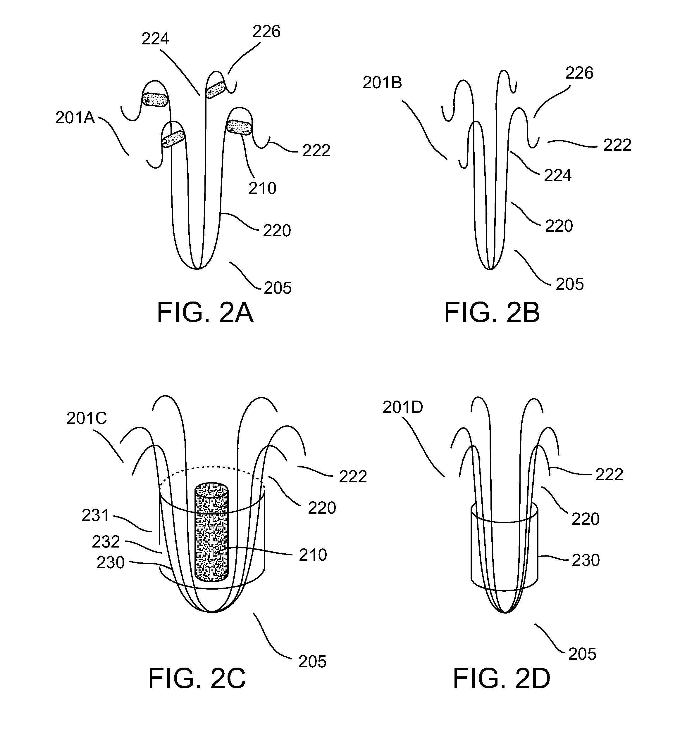 Biodegradable blood vessel occlusion and narrowing
