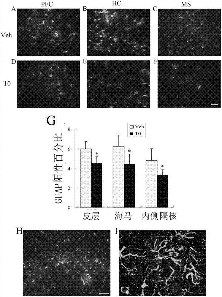 Application of liver X receptor activator in anti-nerve inflammatory reaction