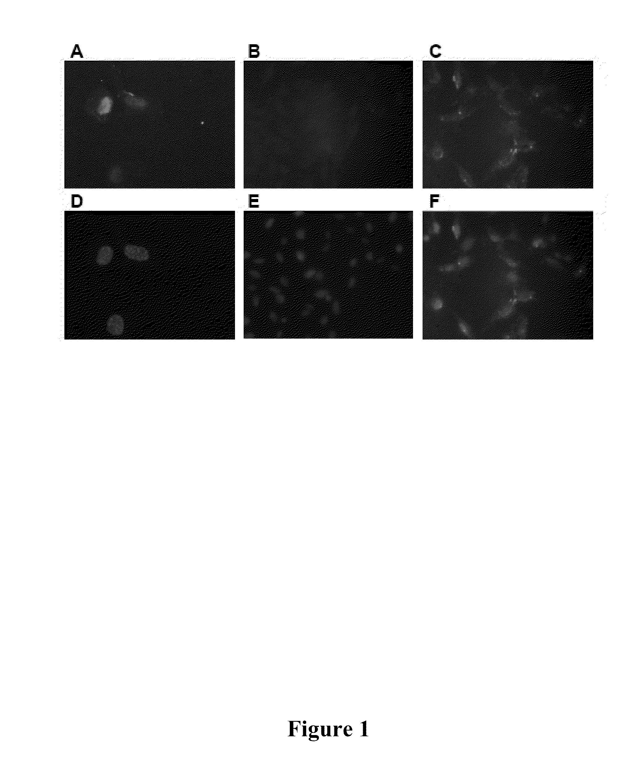 Targeted nanoparticles for intracellular cancer therapy