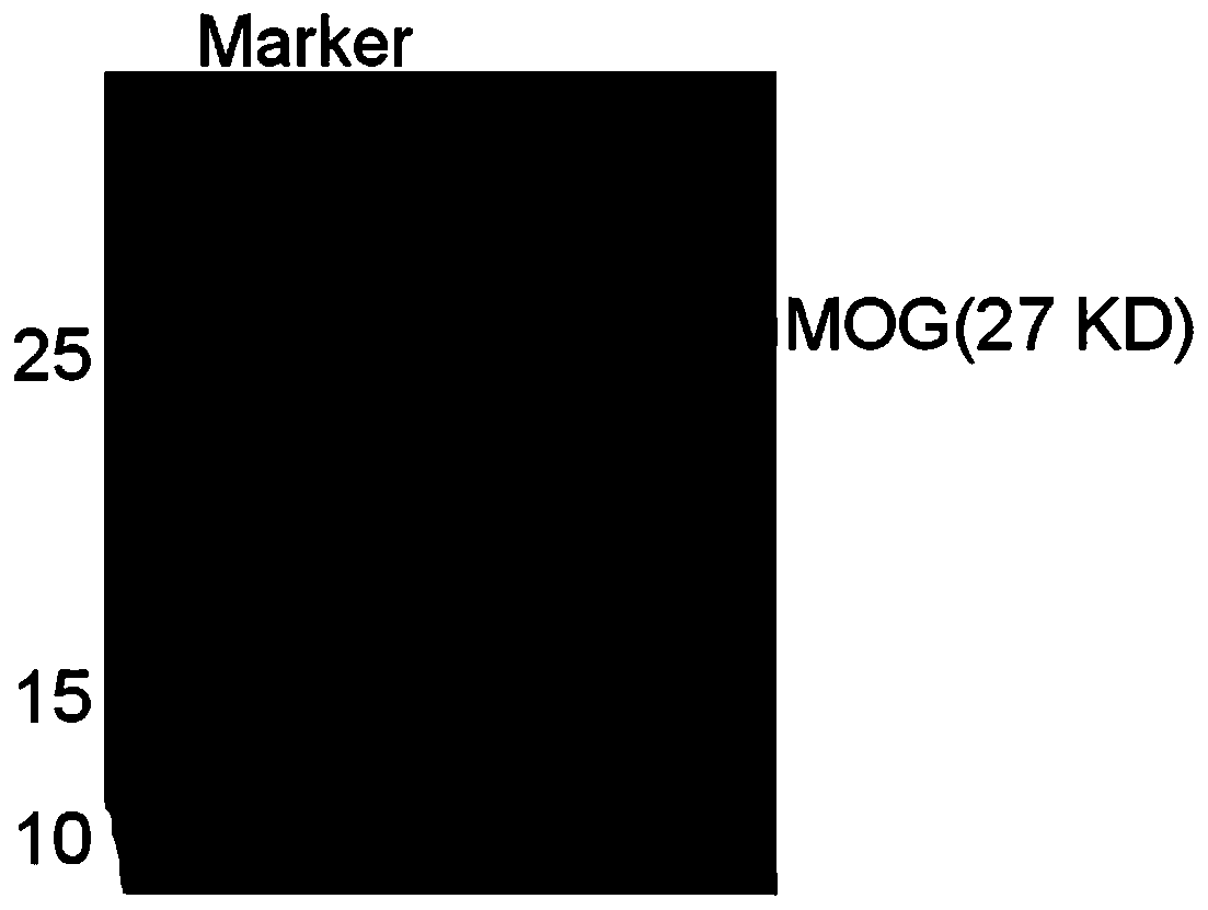 Detection material for anti-myelin oligodendrocyte glycoprotein (MOG) autoantibody in human body fluid, preparation method and application