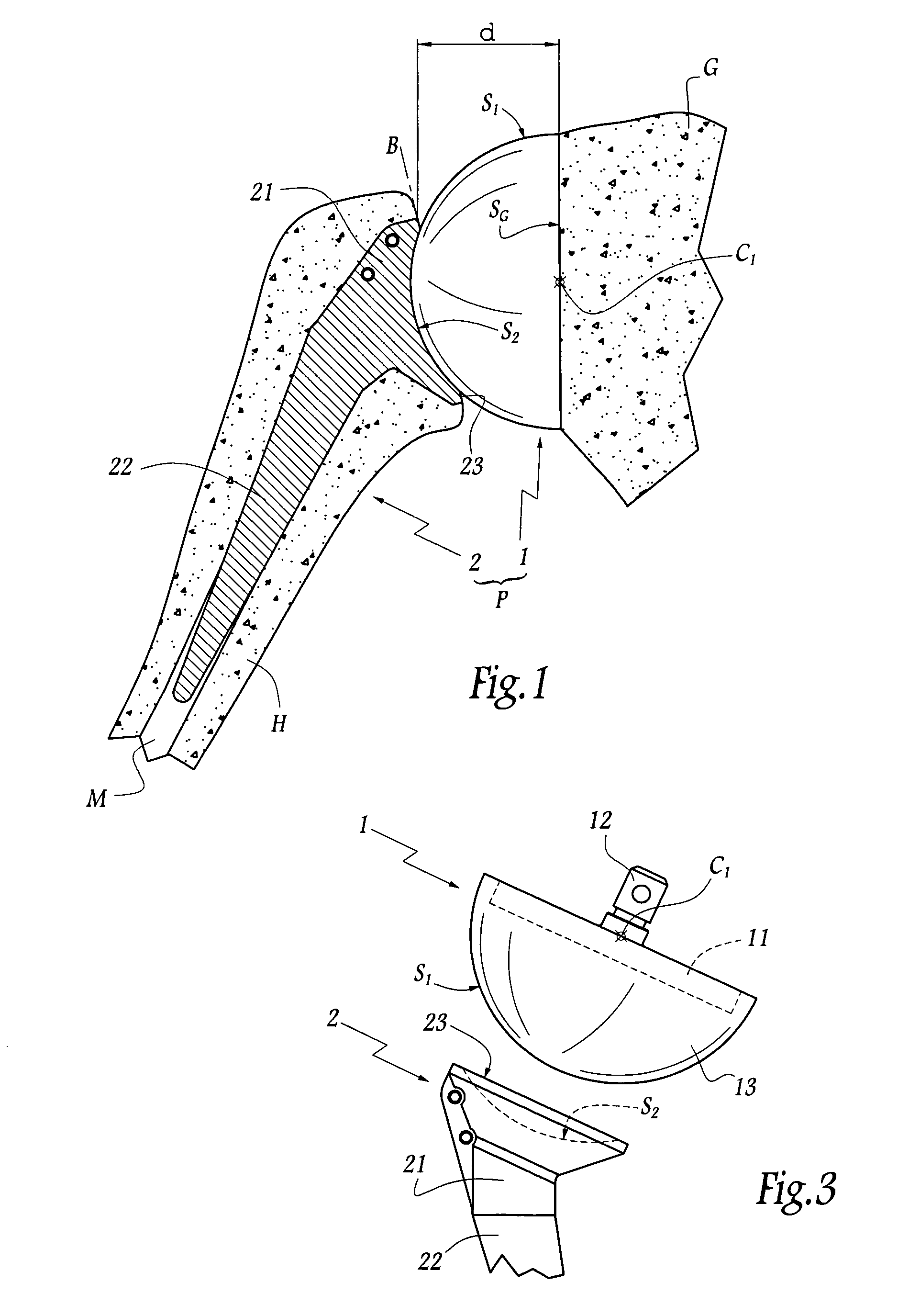 Total shoulder prosthesis of an inverted type