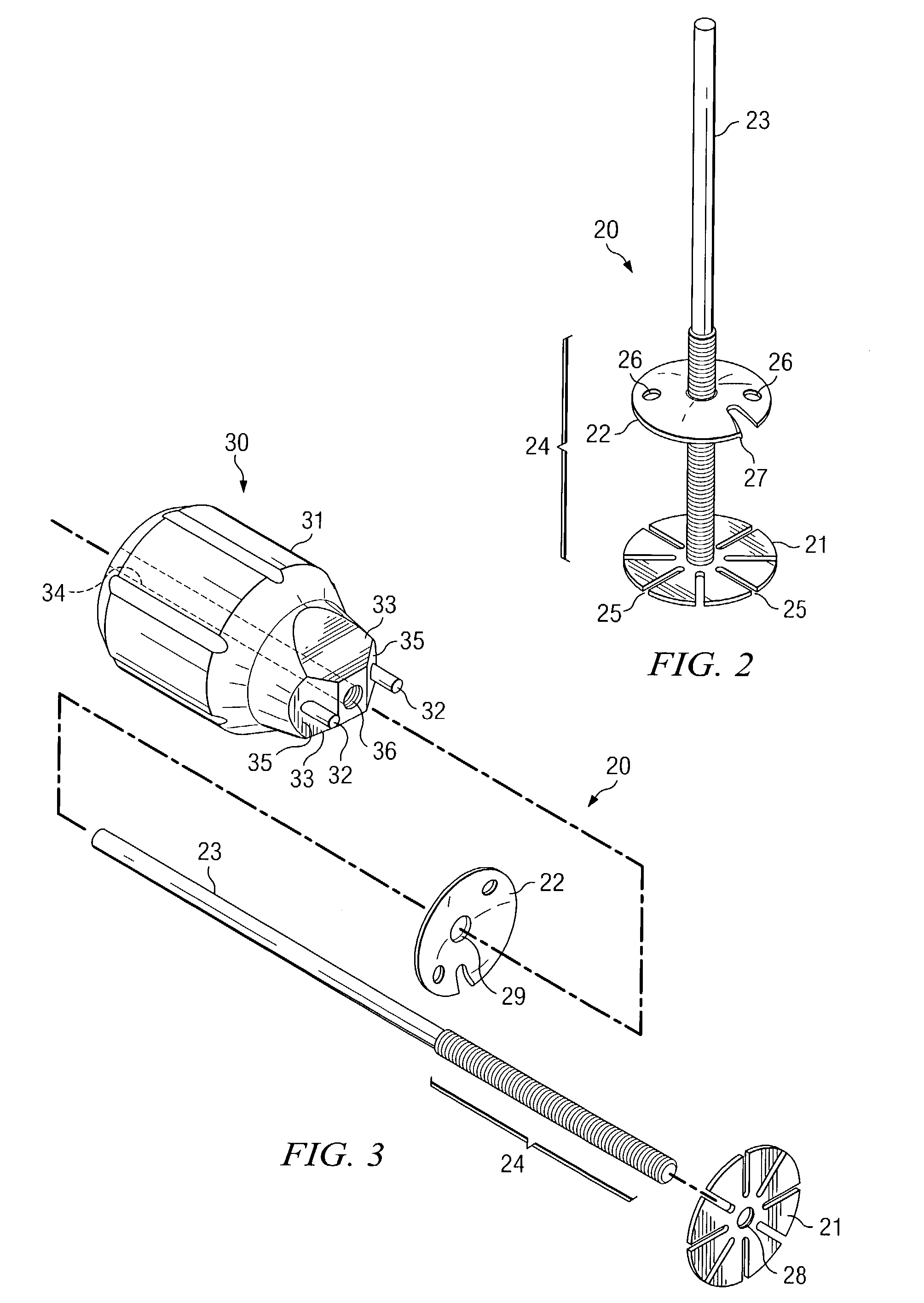 Cranial flap fixation system and method