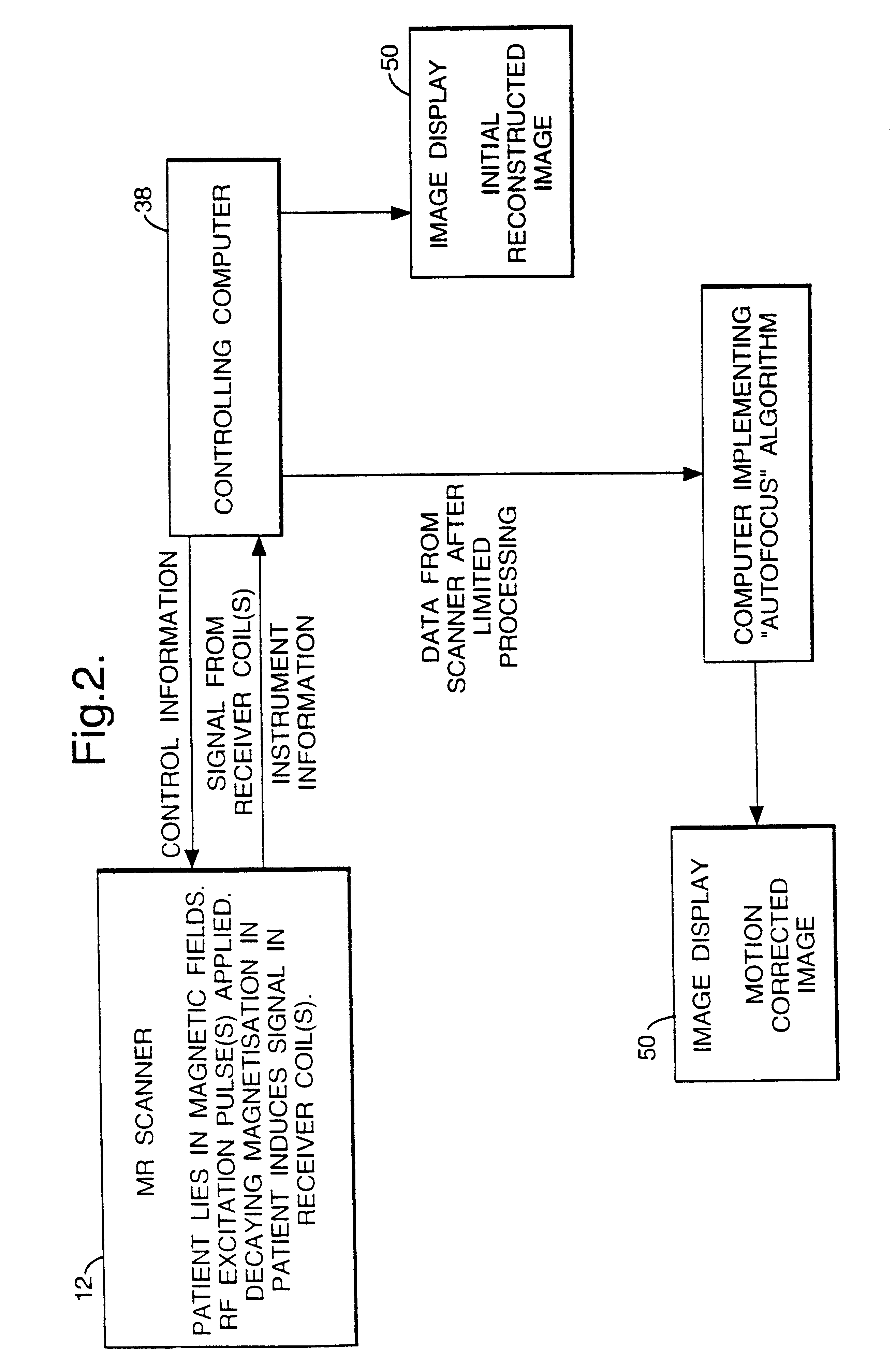 Method and apparatus for imaging artefact reduction