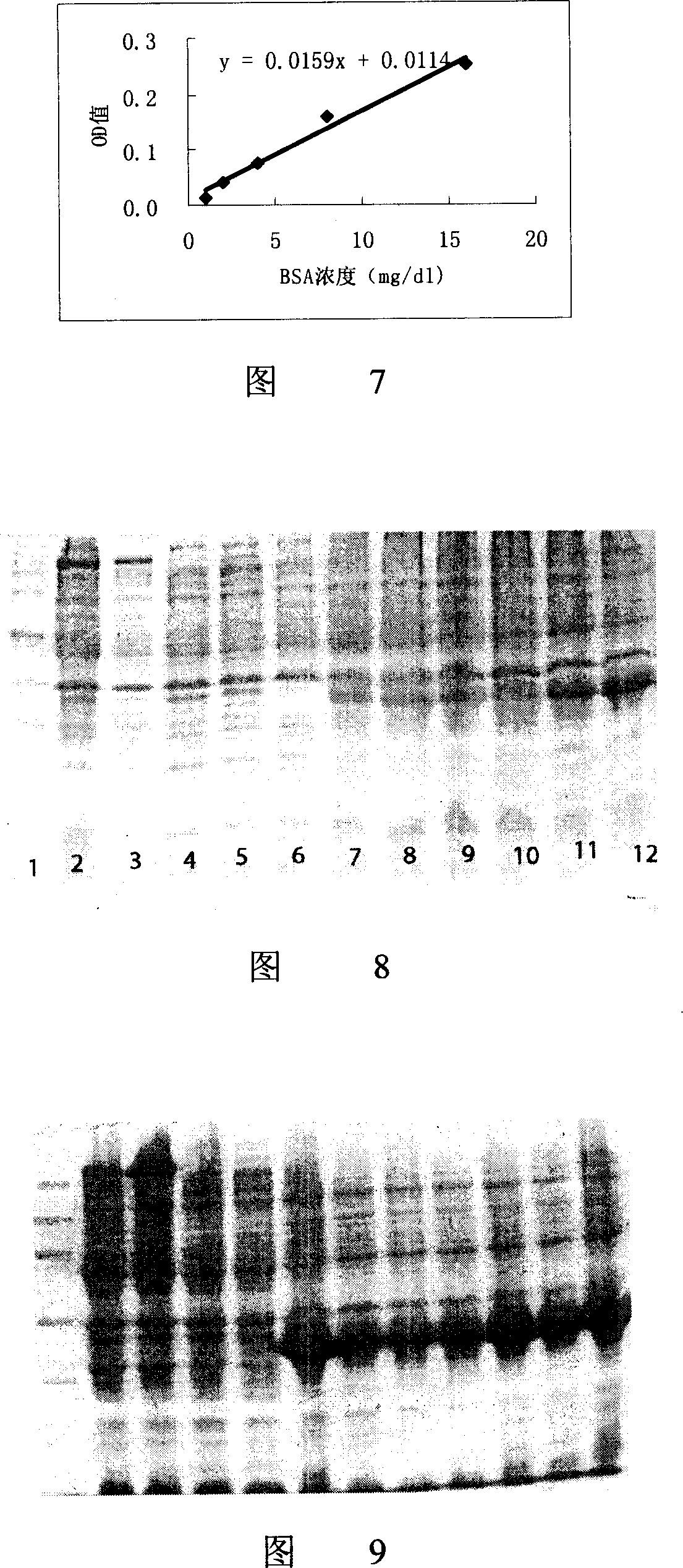 Gene expression product of extro-cellular domain carboxyl end of human thyrotropin receptor, its preparing method and application in enzyme immune technology