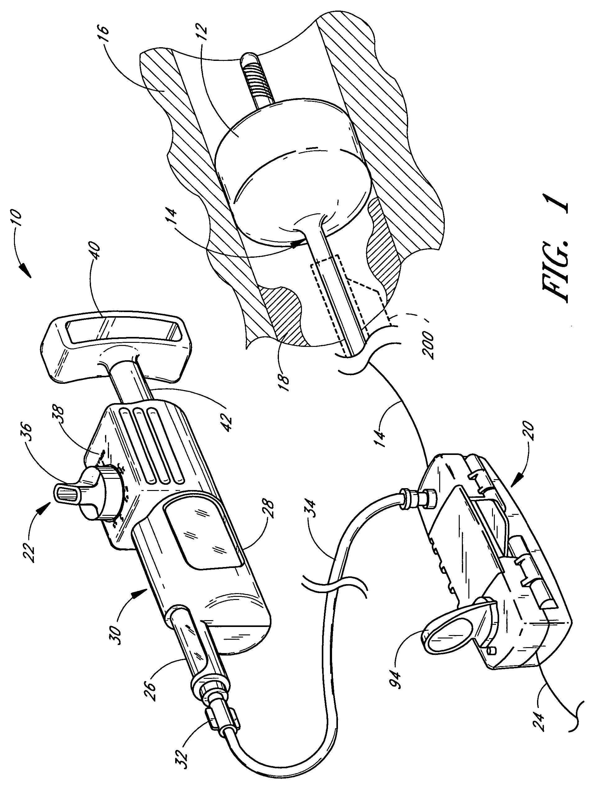 Methods and apparatuses for drug delivery to an intravascular occlusion