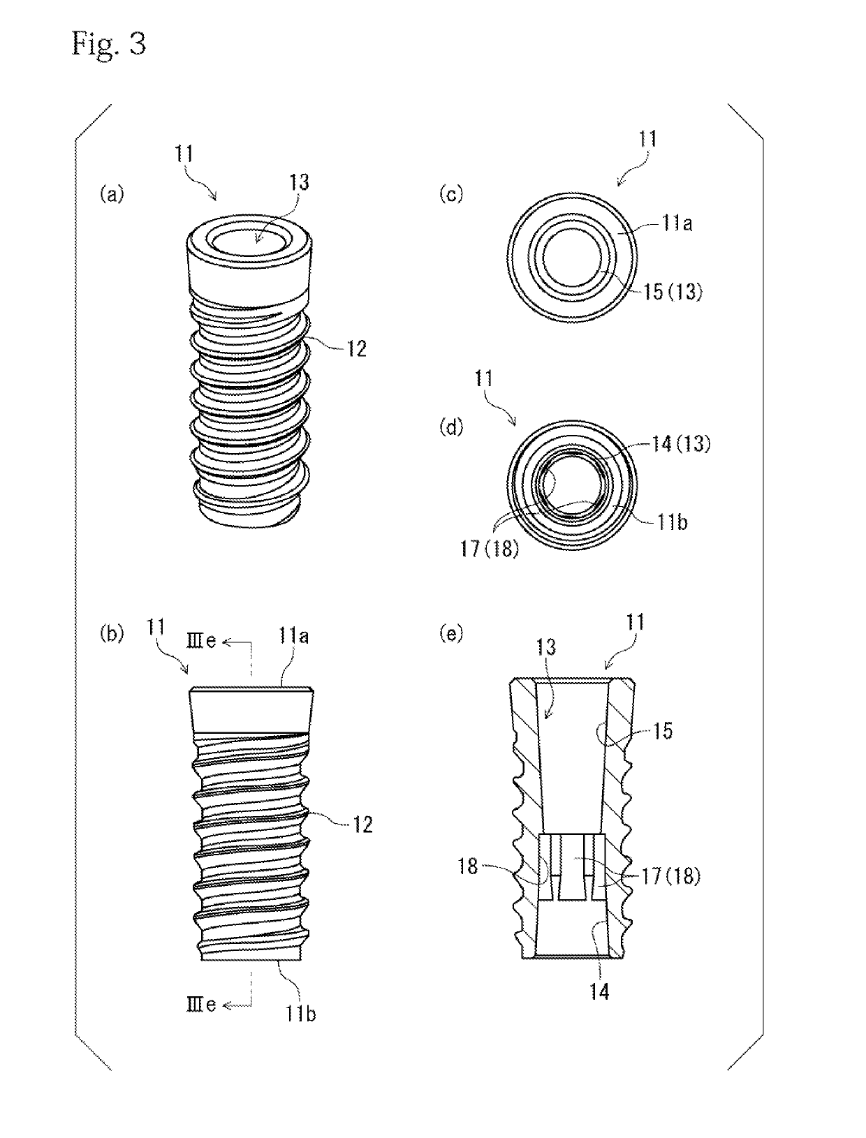 Fixture and implant