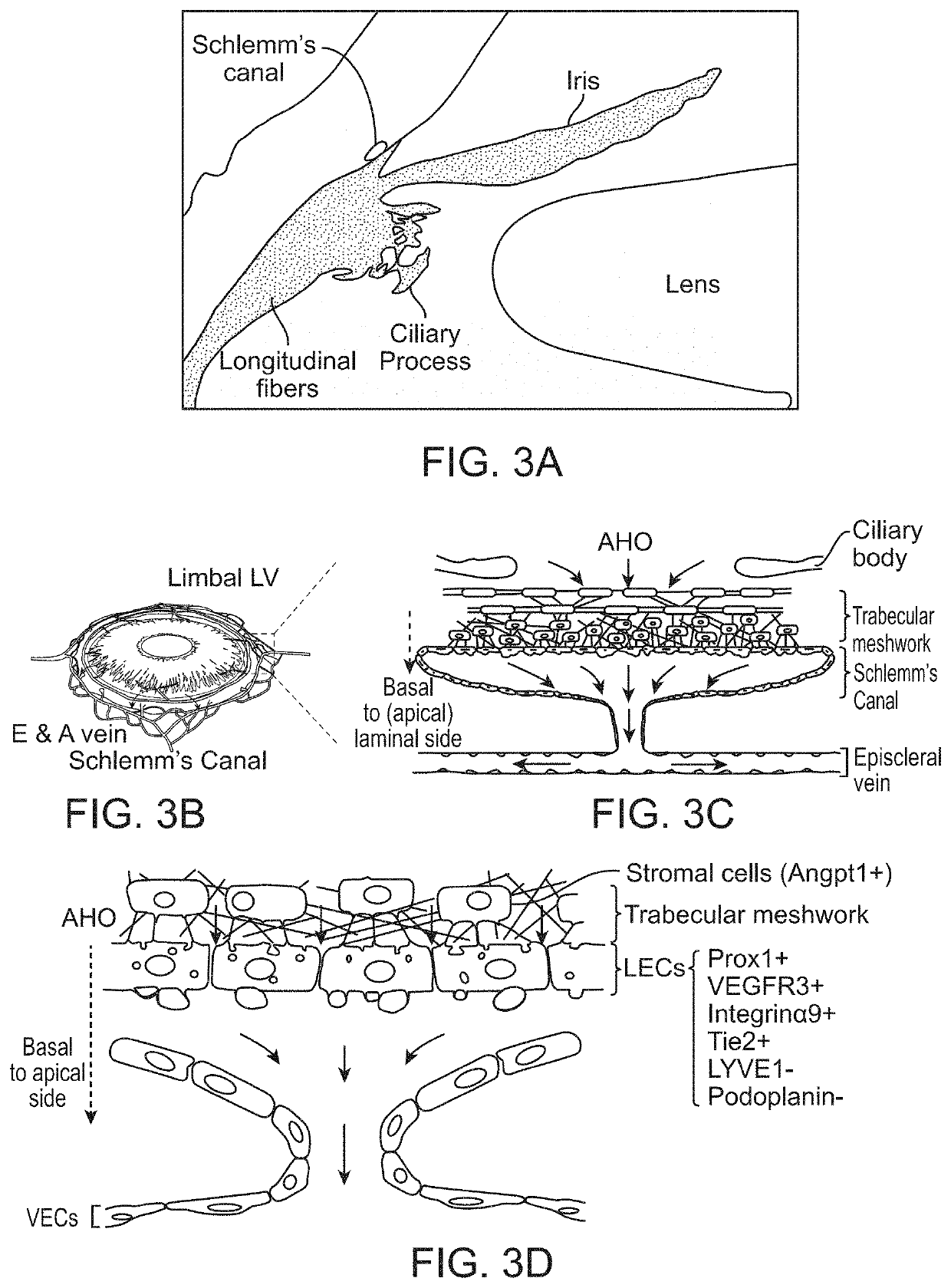 Eye stents and delivery systems