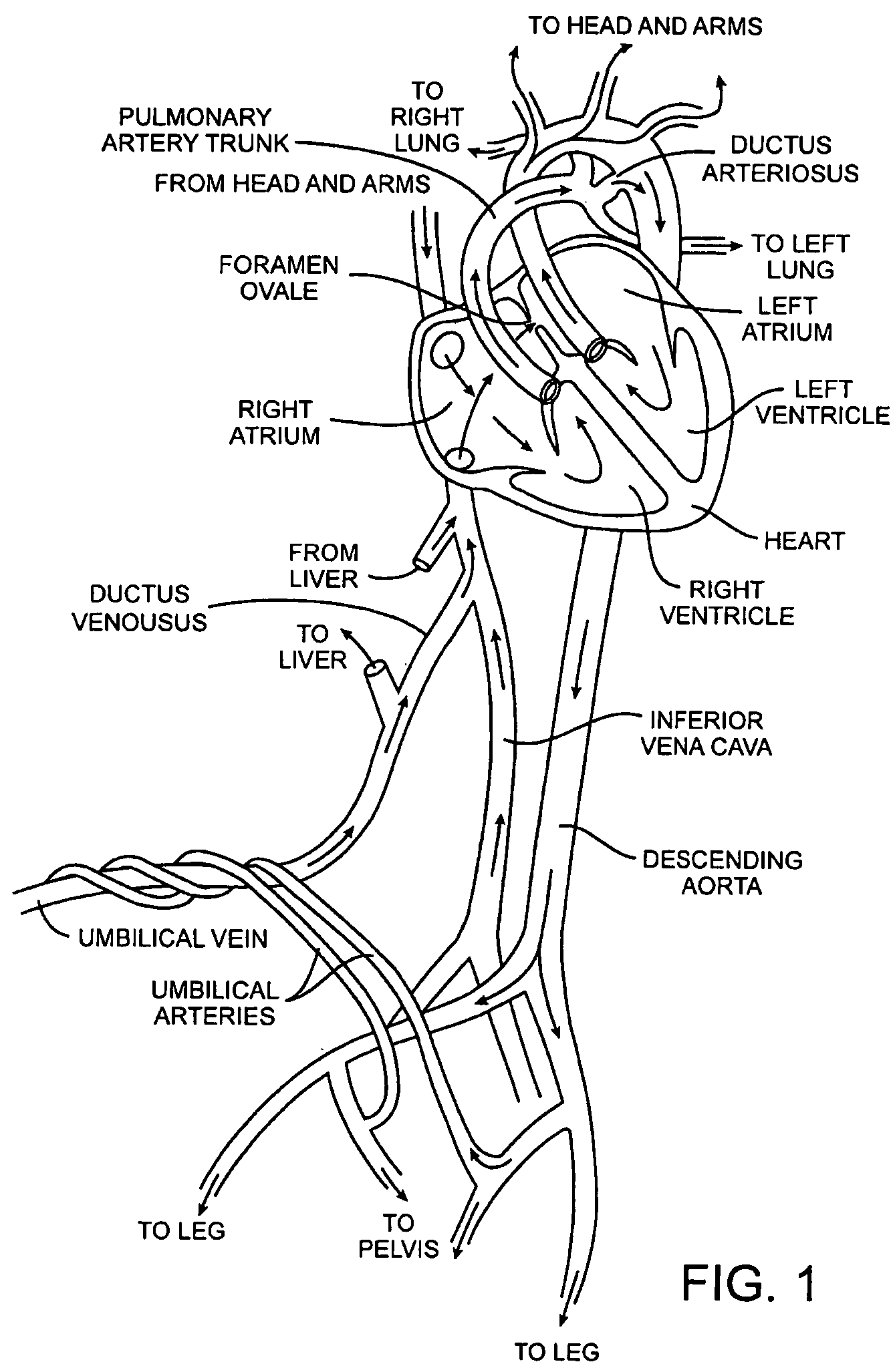 Energy based devices and methods for treatment of patent foramen ovale