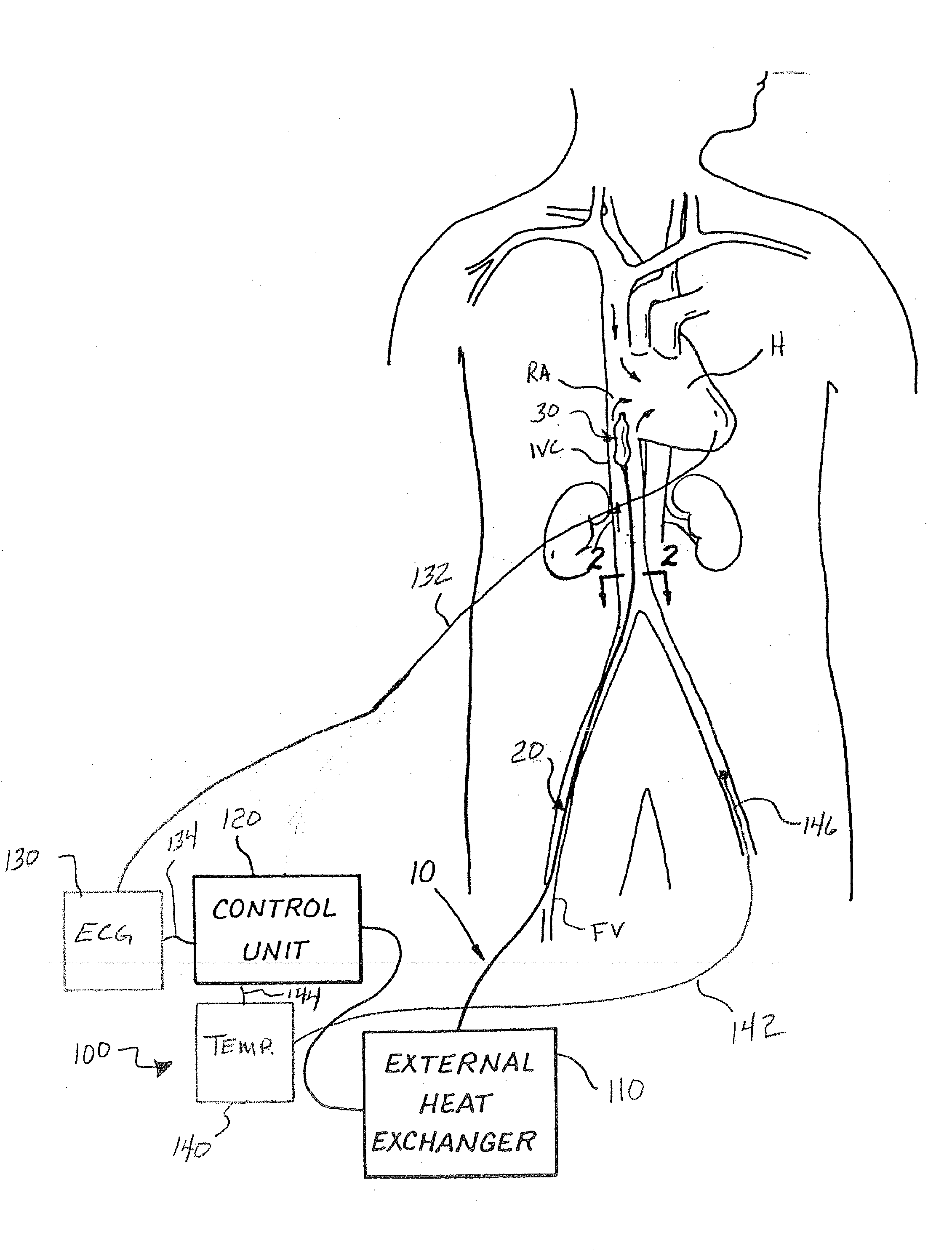Methods and systems for reducing substance-induced renal damage