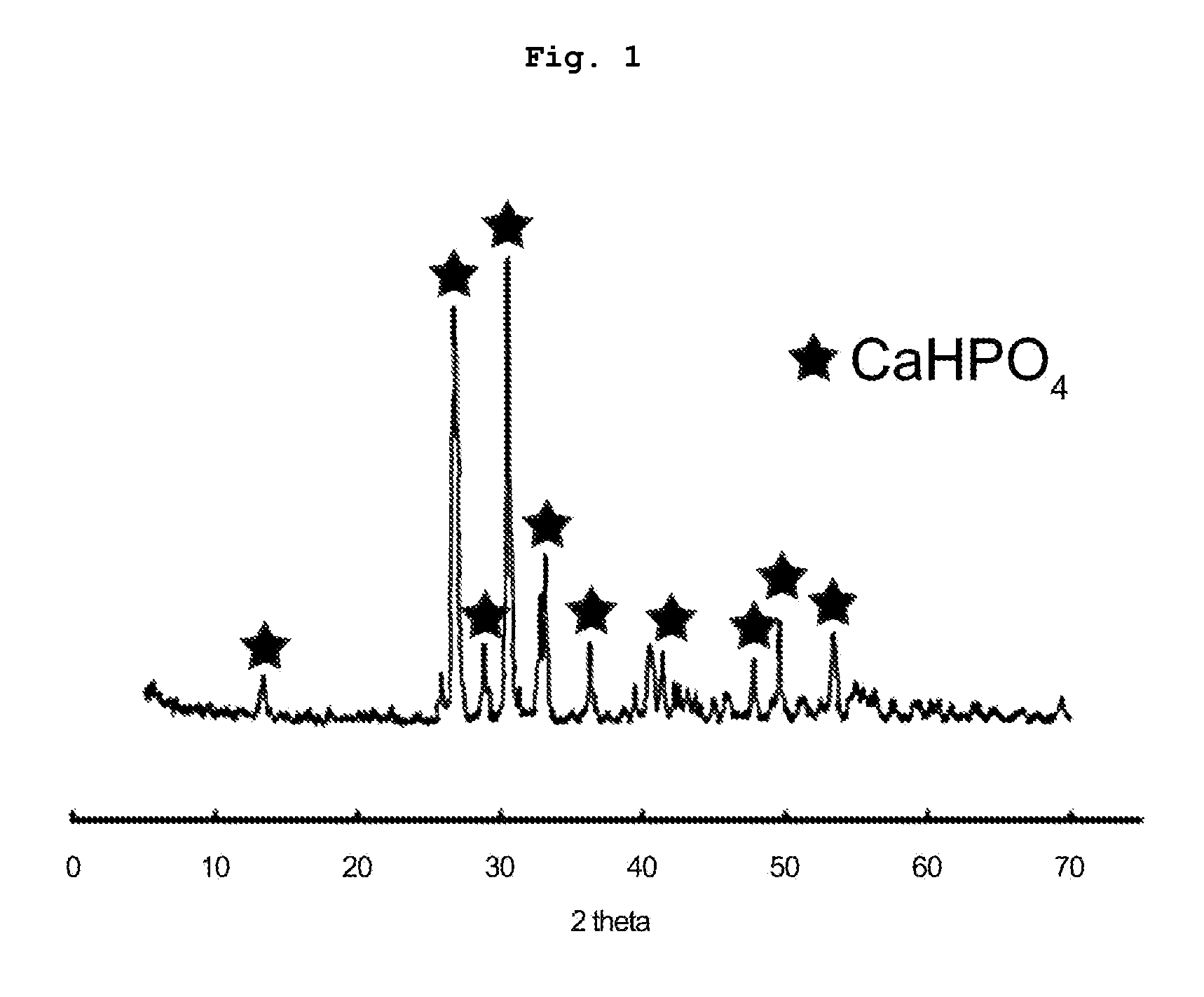 Method for preparing ceramic waste form containing radioactive rare-earth and transuranic oxide, and ceramic waste form with enhanced density, heat-stability, and leach resistance prepared by the same
