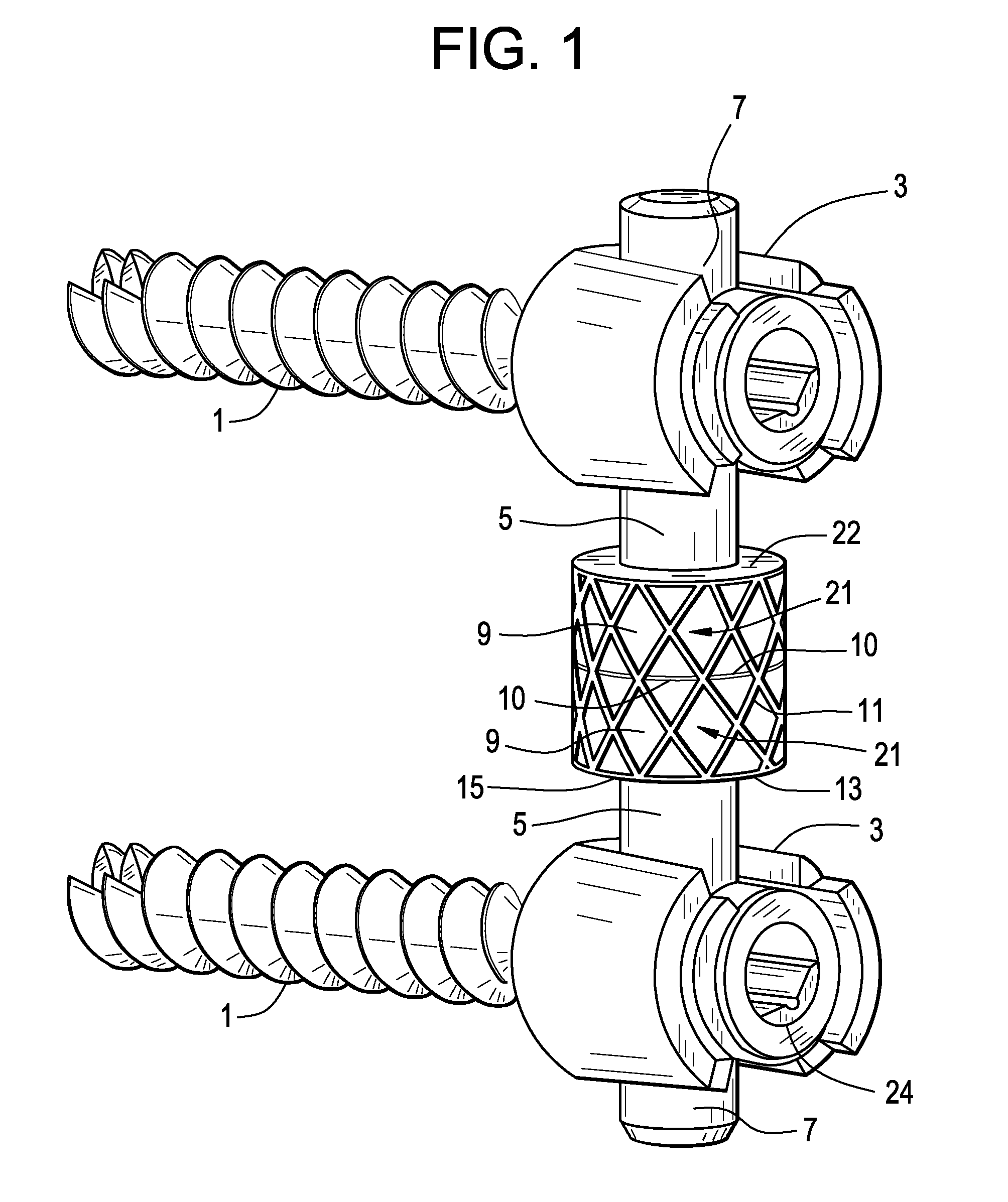 Posterior Dynamic Stabilization System With Flexible Ligament
