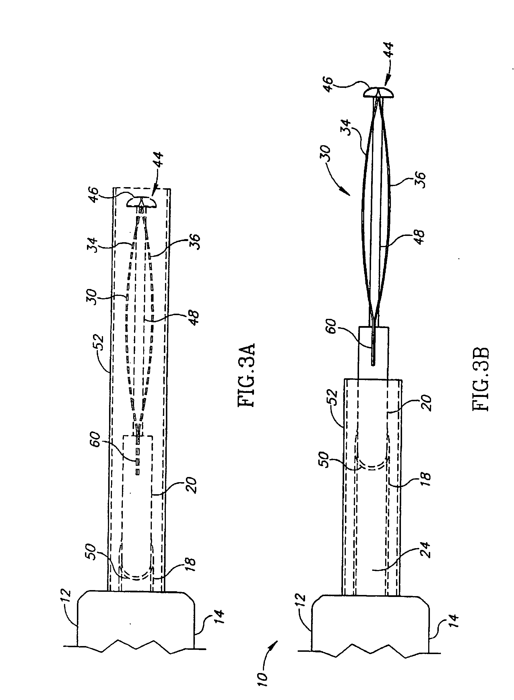 Thermal capsulotomy tool and system