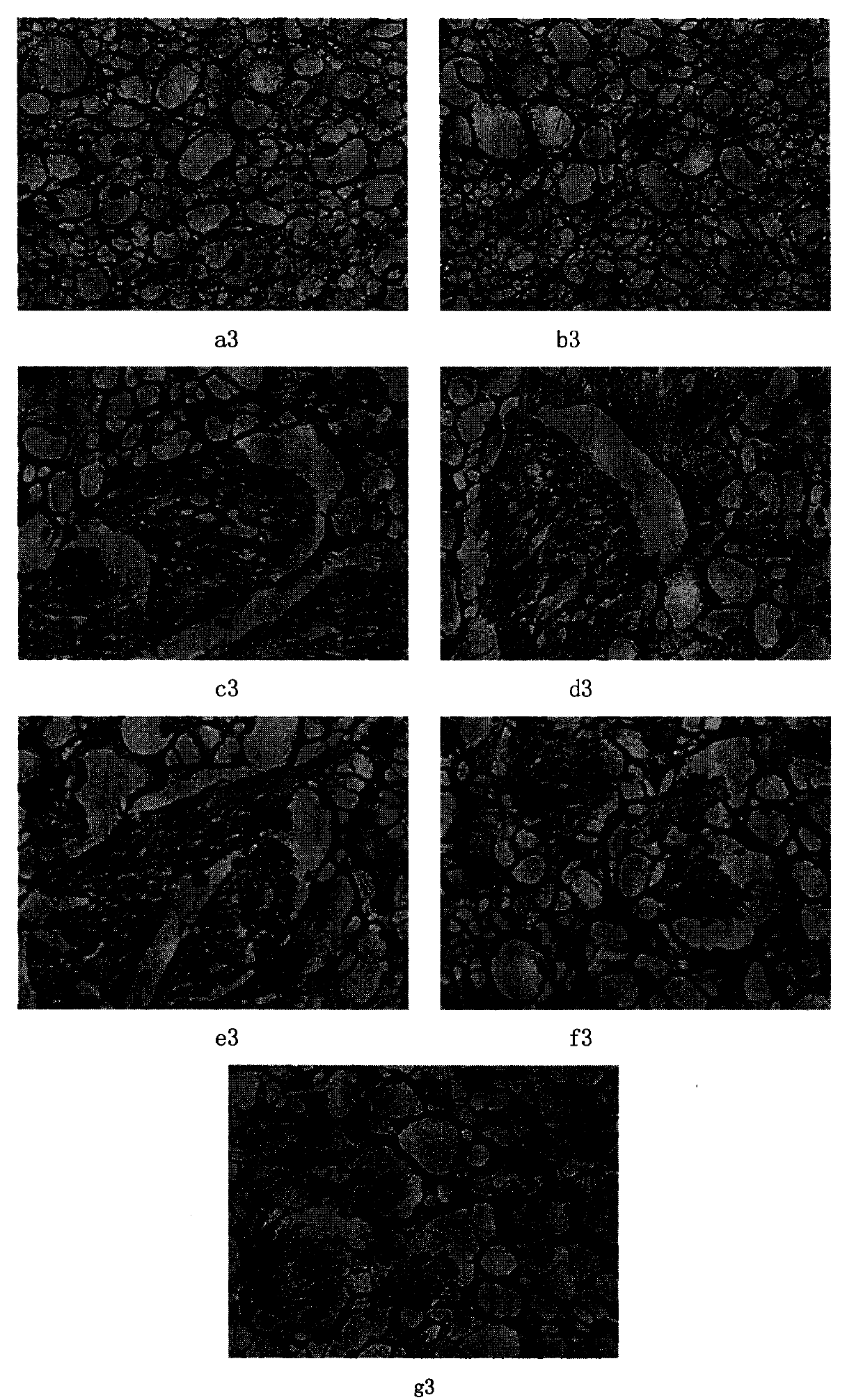 Medicament for treating senile dementia and preparation method thereof