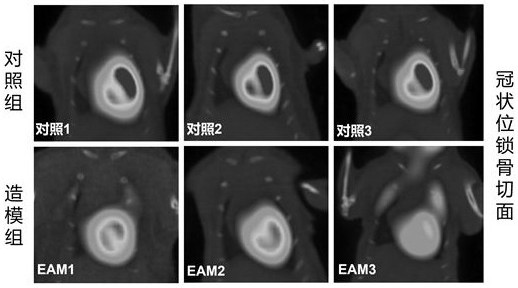 A method for establishing an eam mouse model induced by an autoantigen epitope