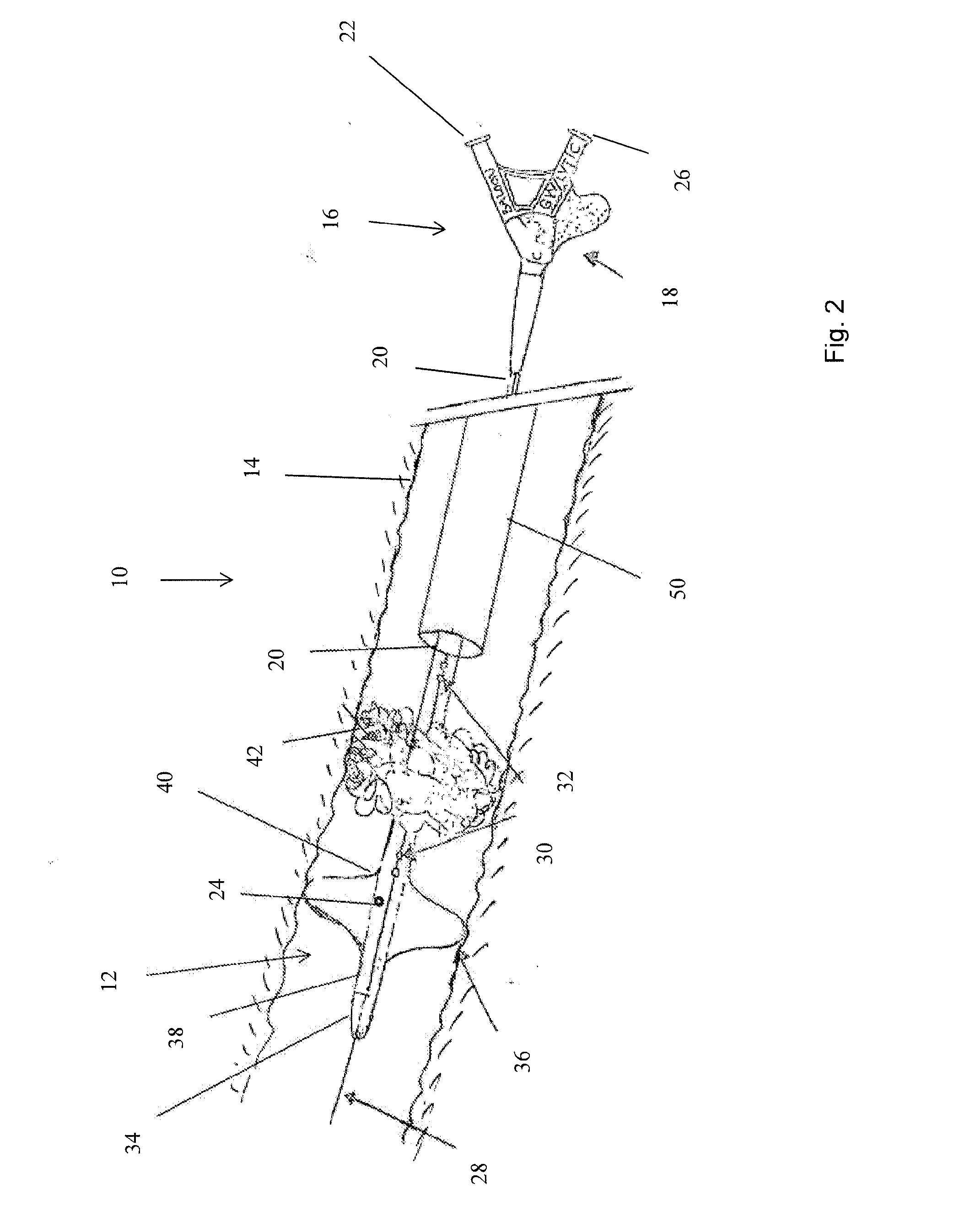 Thrombus removal apparatus and method