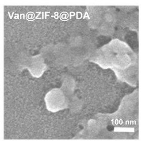 Preparation method and application of zinc organic framework composite material for photoresponsively releasing vancomycin