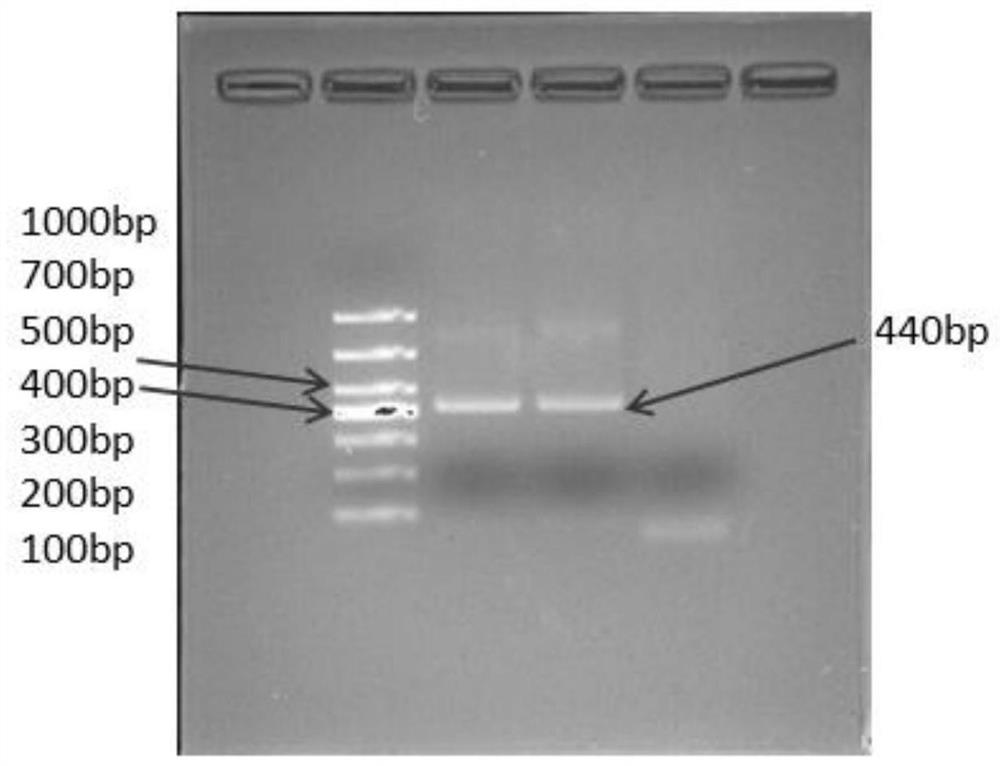 A kind of preparation method of goose gout yolk antibody