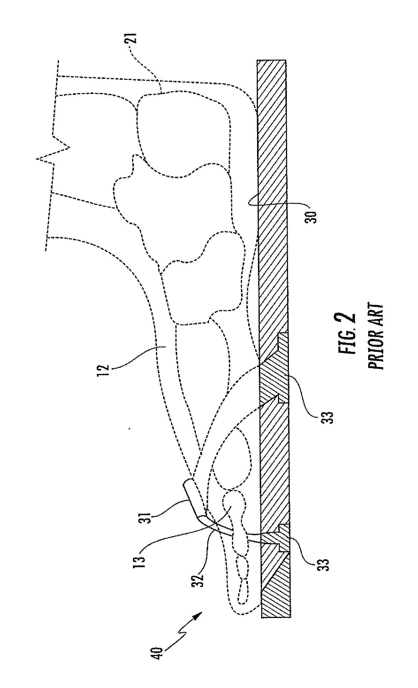 Shoe engagement and bumper insert system and method for using the same